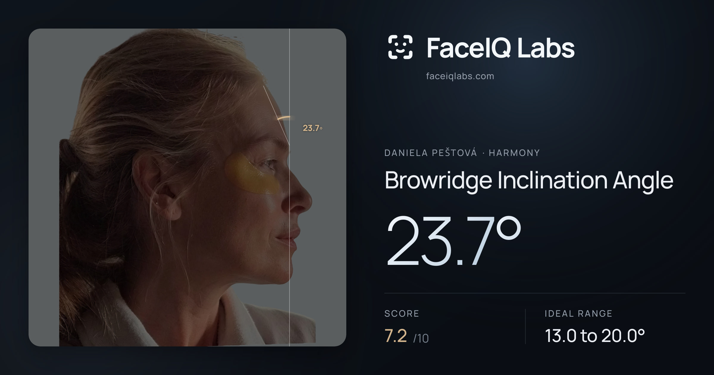 Daniela Peštová Browridge Inclination Angle: 23.7°, drawn on the photo
