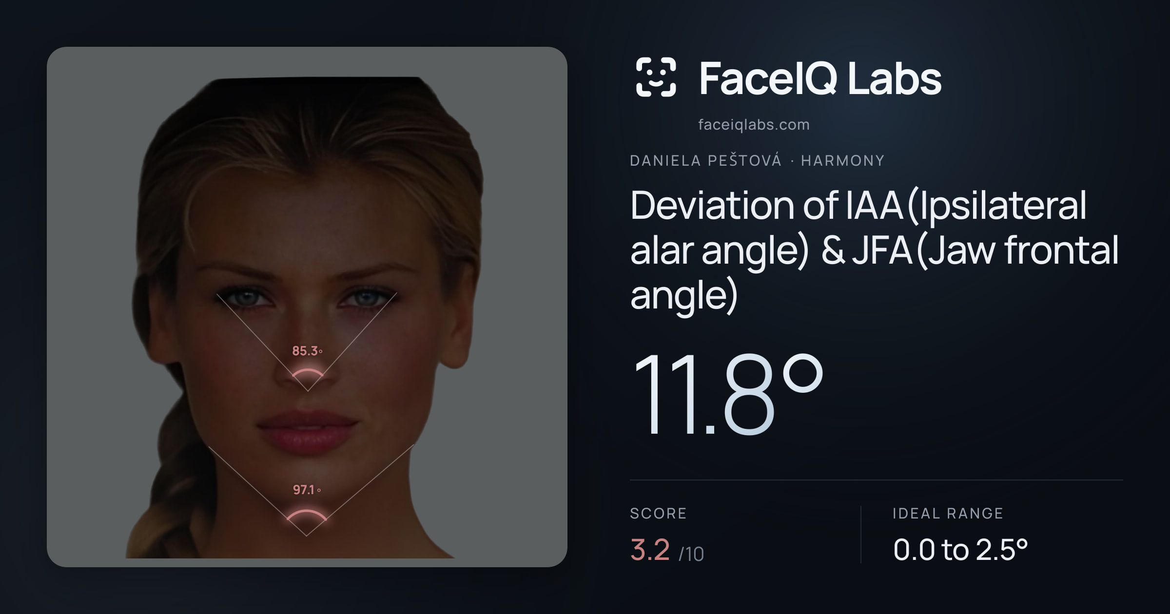 Daniela Peštová Deviation of IAA(Ipsilateral alar angle) & JFA(Jaw frontal angle): 11.8°, drawn on the photo