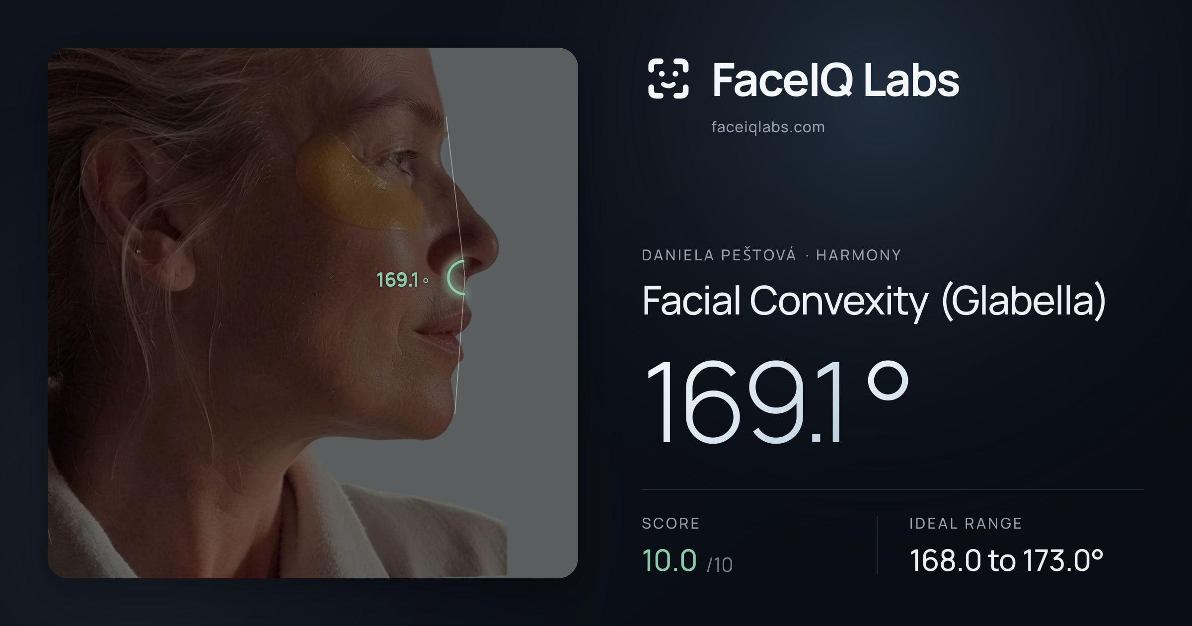 Daniela Peštová Facial Convexity (Glabella): 169.1°, drawn on the photo