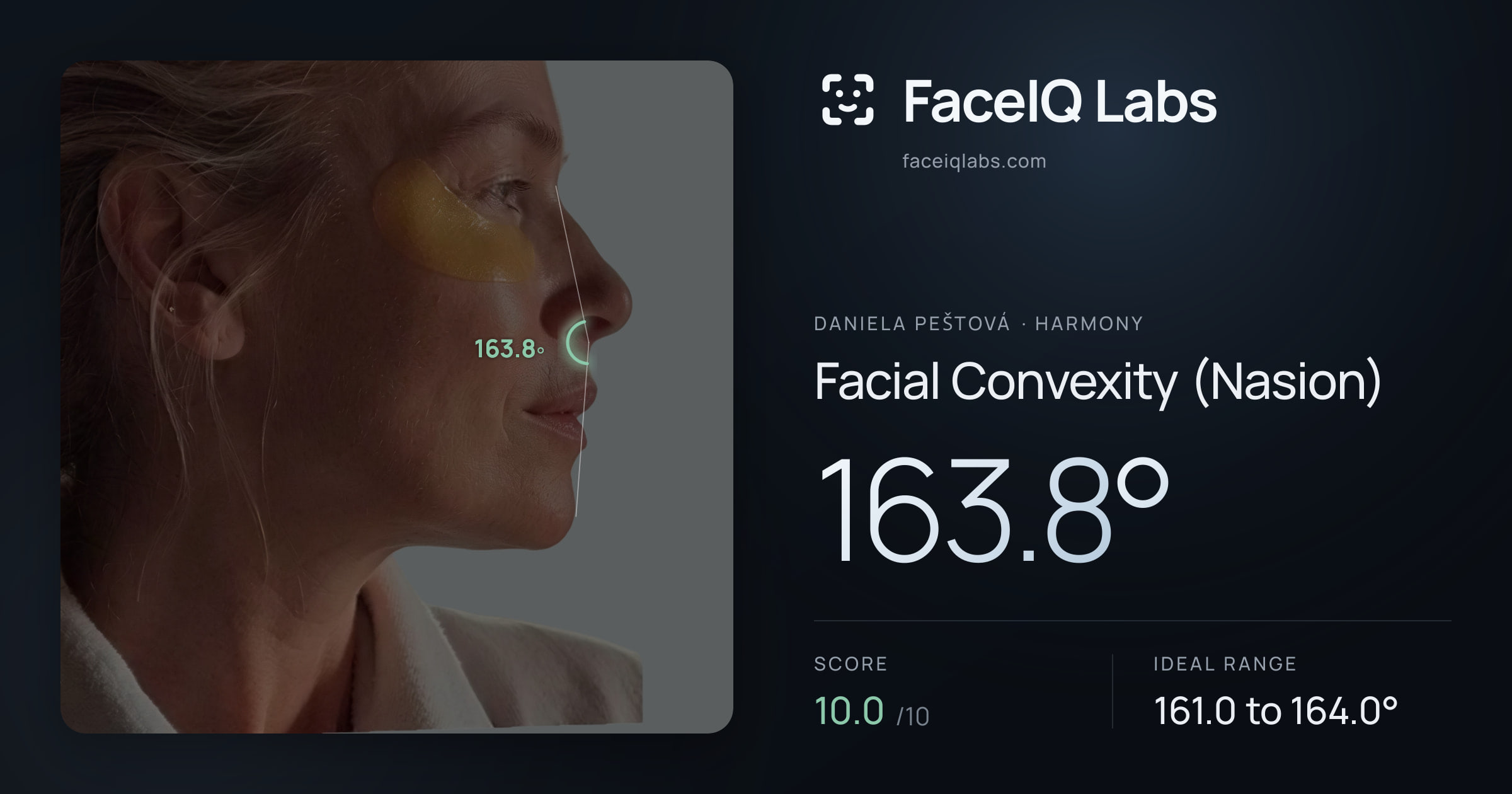 Daniela Peštová Facial Convexity (Nasion): 163.8°, drawn on the photo