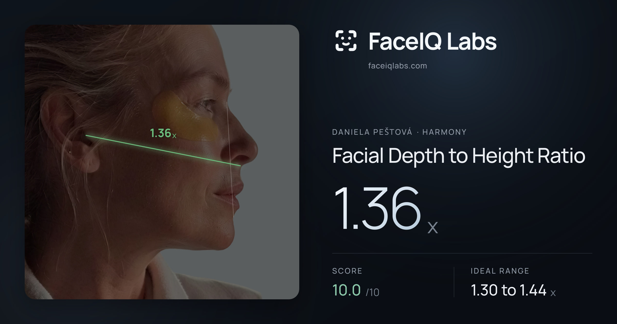 Daniela Peštová Facial Depth to Height Ratio: 1.36x, drawn on the photo