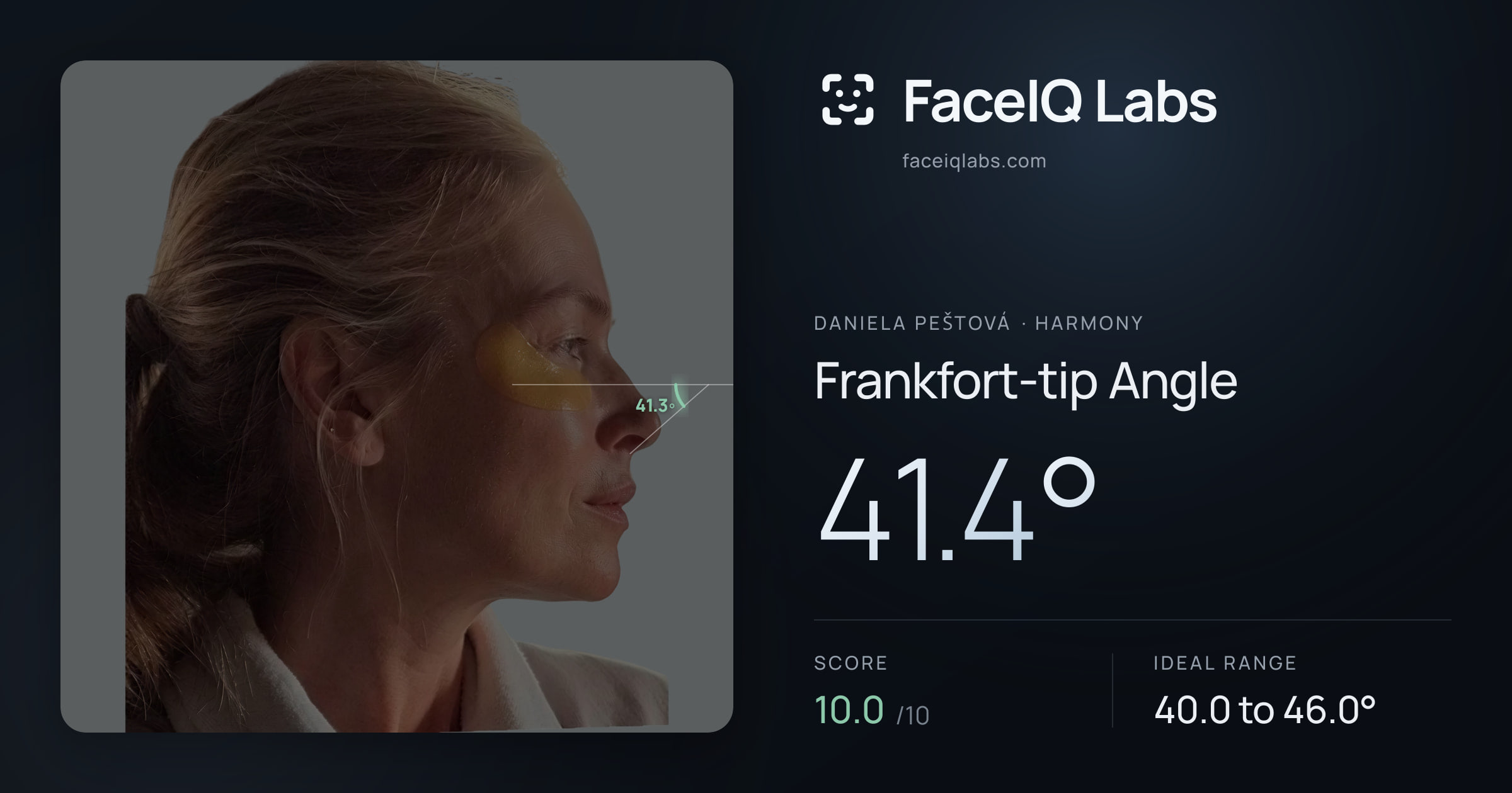 Daniela Peštová Frankfort-tip Angle: 41.4°, drawn on the photo