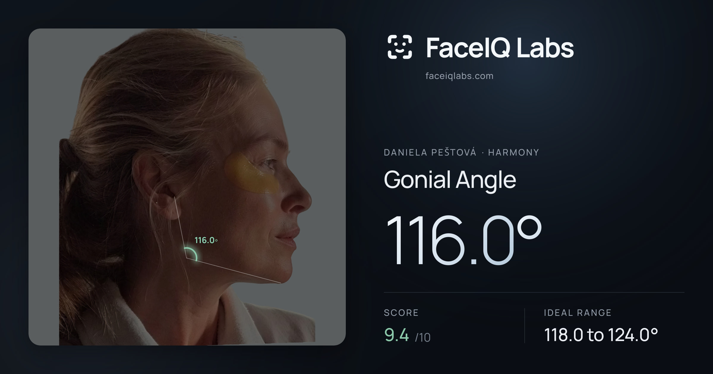 Daniela Peštová Gonial Angle: 116.0°, drawn on the photo