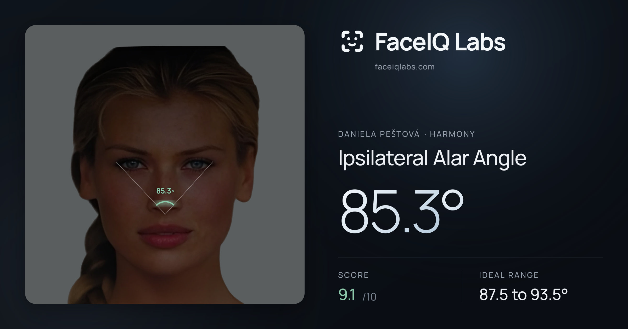 Daniela Peštová Ipsilateral Alar Angle: 85.3°, drawn on the photo