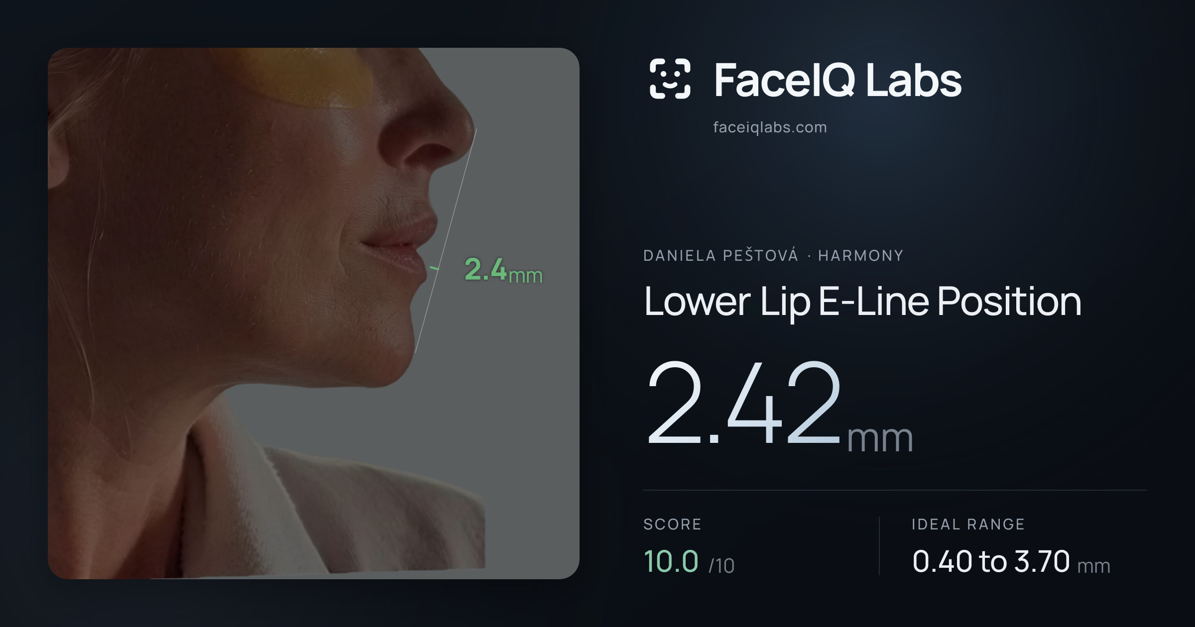Daniela Peštová Lower Lip E-Line Position: 2.42mm, drawn on the photo