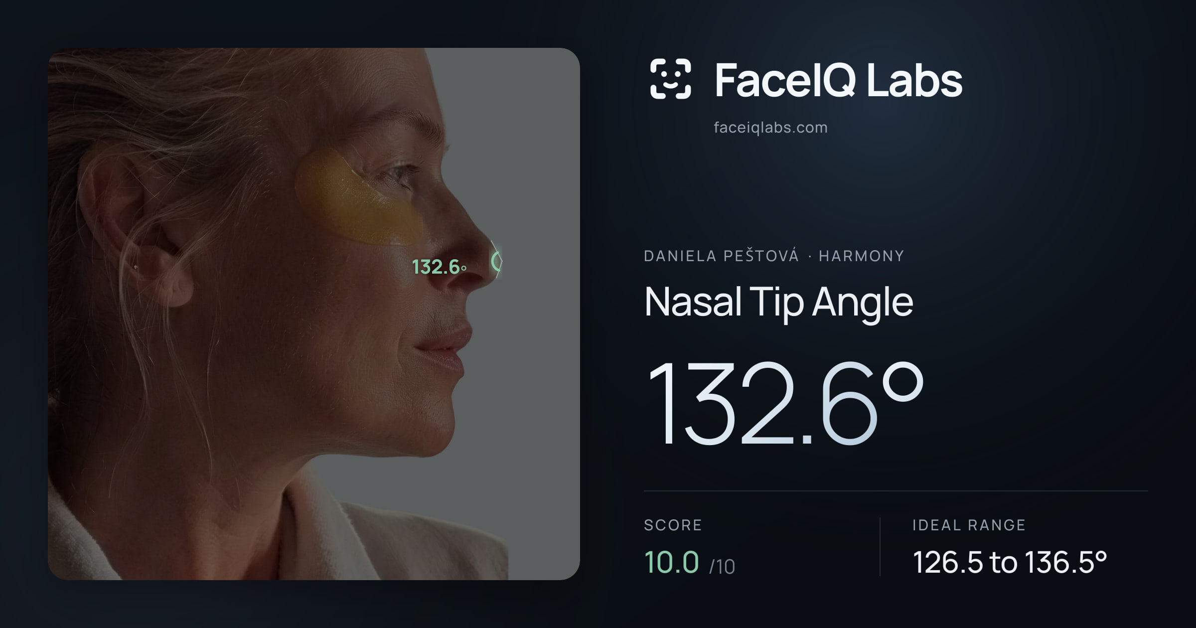 Daniela Peštová Nasal Tip Angle: 132.6°, drawn on the photo