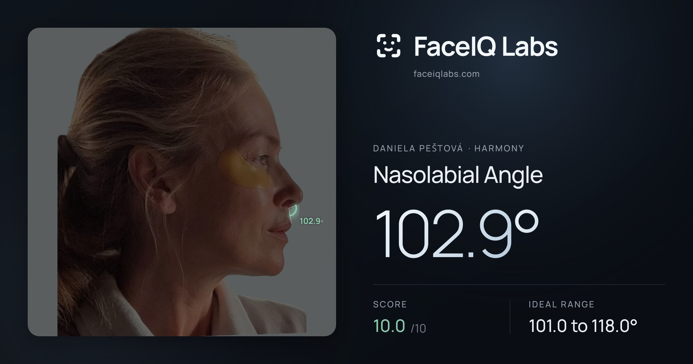 Daniela Peštová Nasolabial Angle: 102.9°, drawn on the photo
