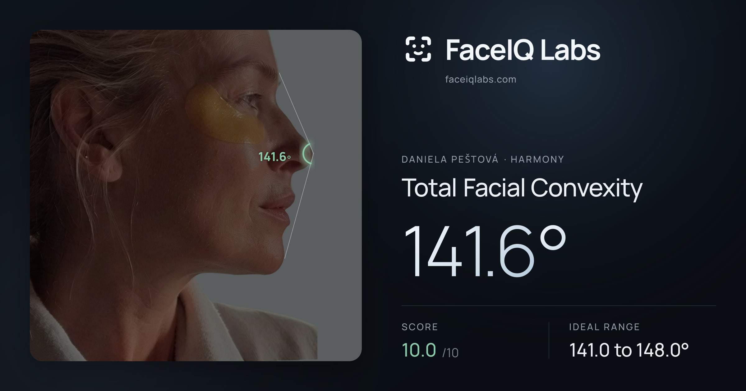 Daniela Peštová Total Facial Convexity: 141.6°, drawn on the photo