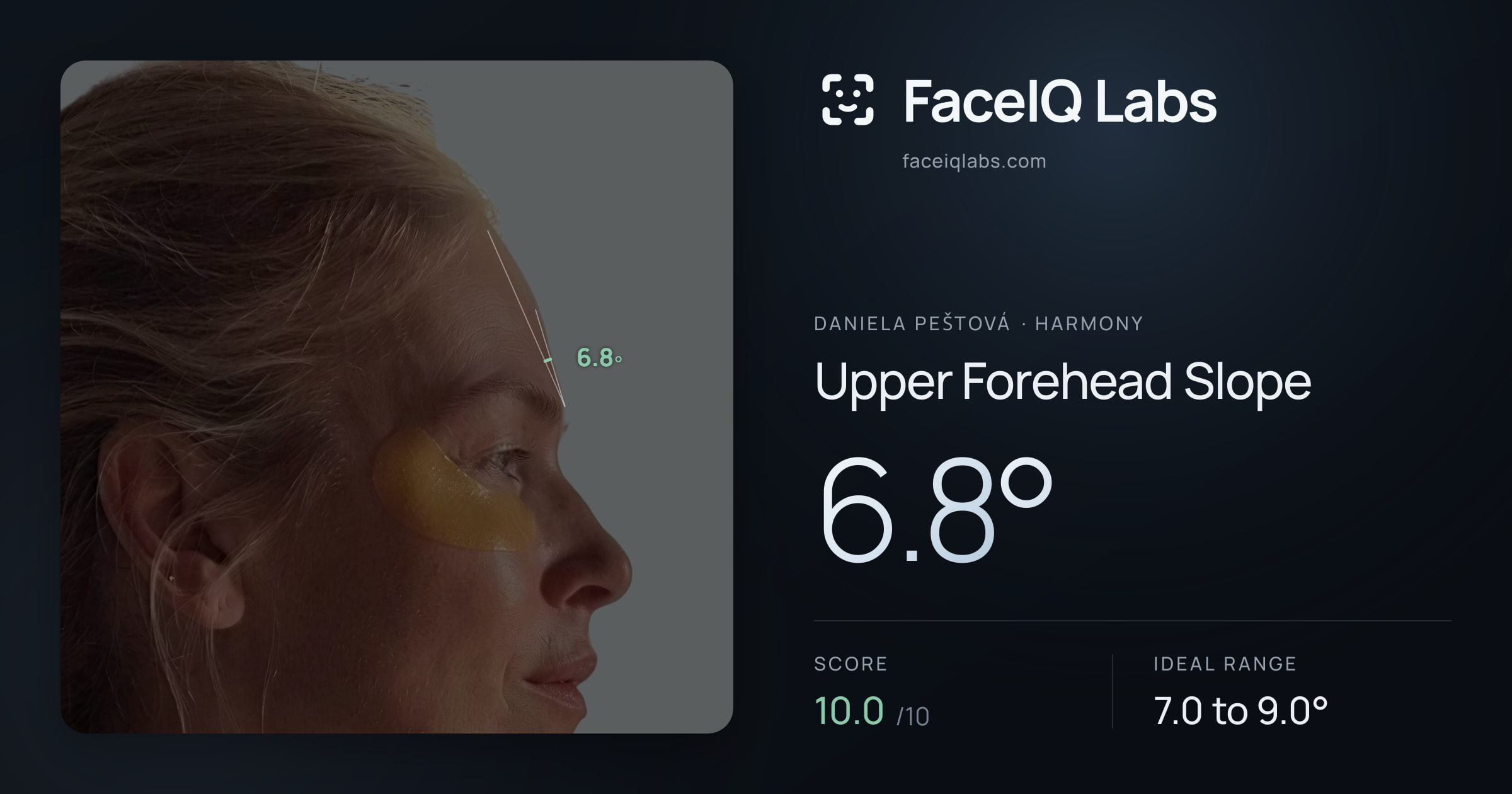 Daniela Peštová Upper Forehead Slope: 6.8°, drawn on the photo