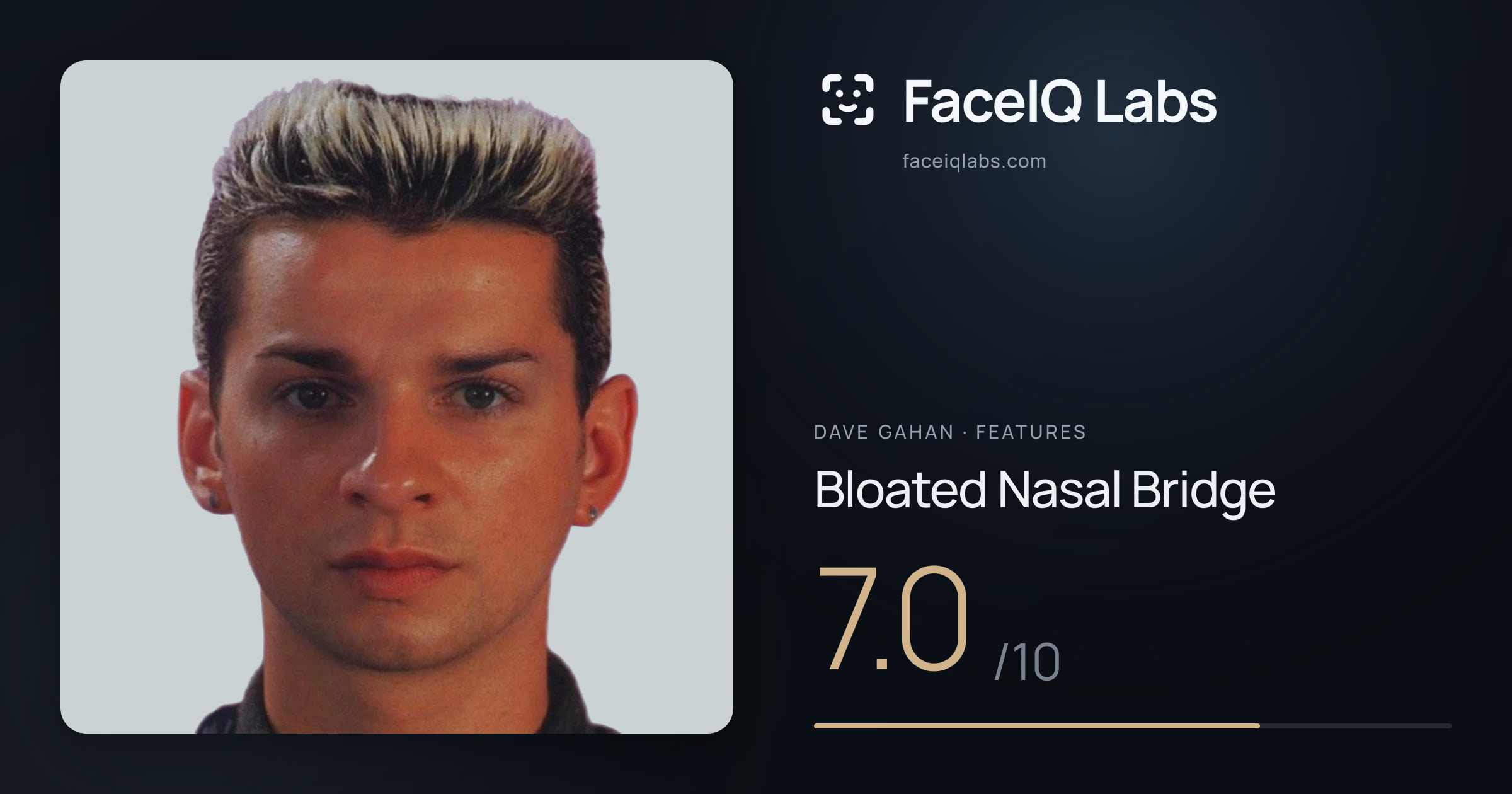 Dave Gahan Bloated Nasal Bridge: 7.0/10, drawn on the photo