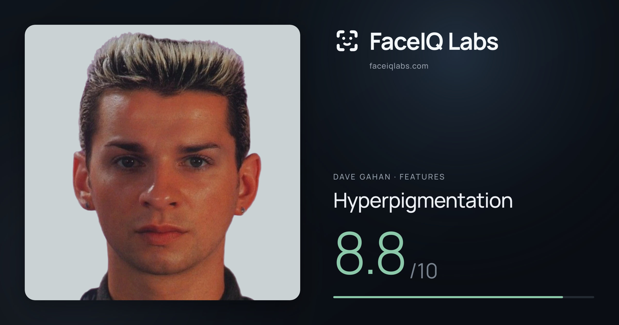 Dave Gahan Hyperpigmentation: 8.8/10, drawn on the photo