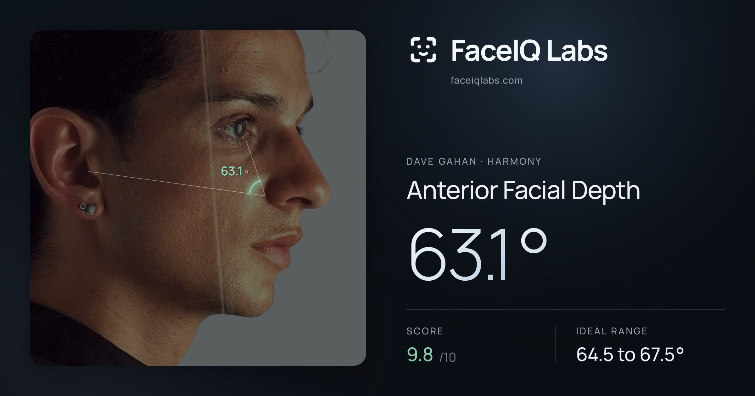 Dave Gahan Anterior Facial Depth: 63.1°, drawn on the photo