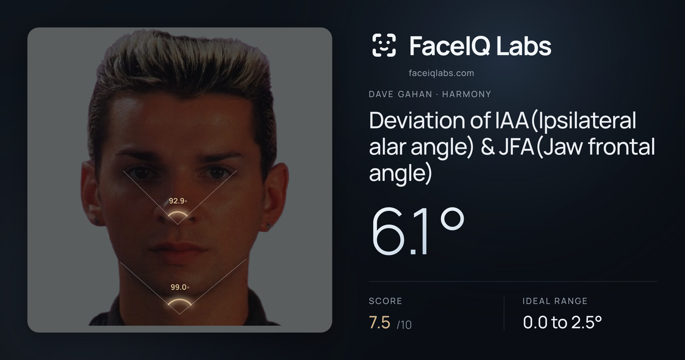 Dave Gahan Deviation of IAA(Ipsilateral alar angle) & JFA(Jaw frontal angle): 6.1°, drawn on the photo