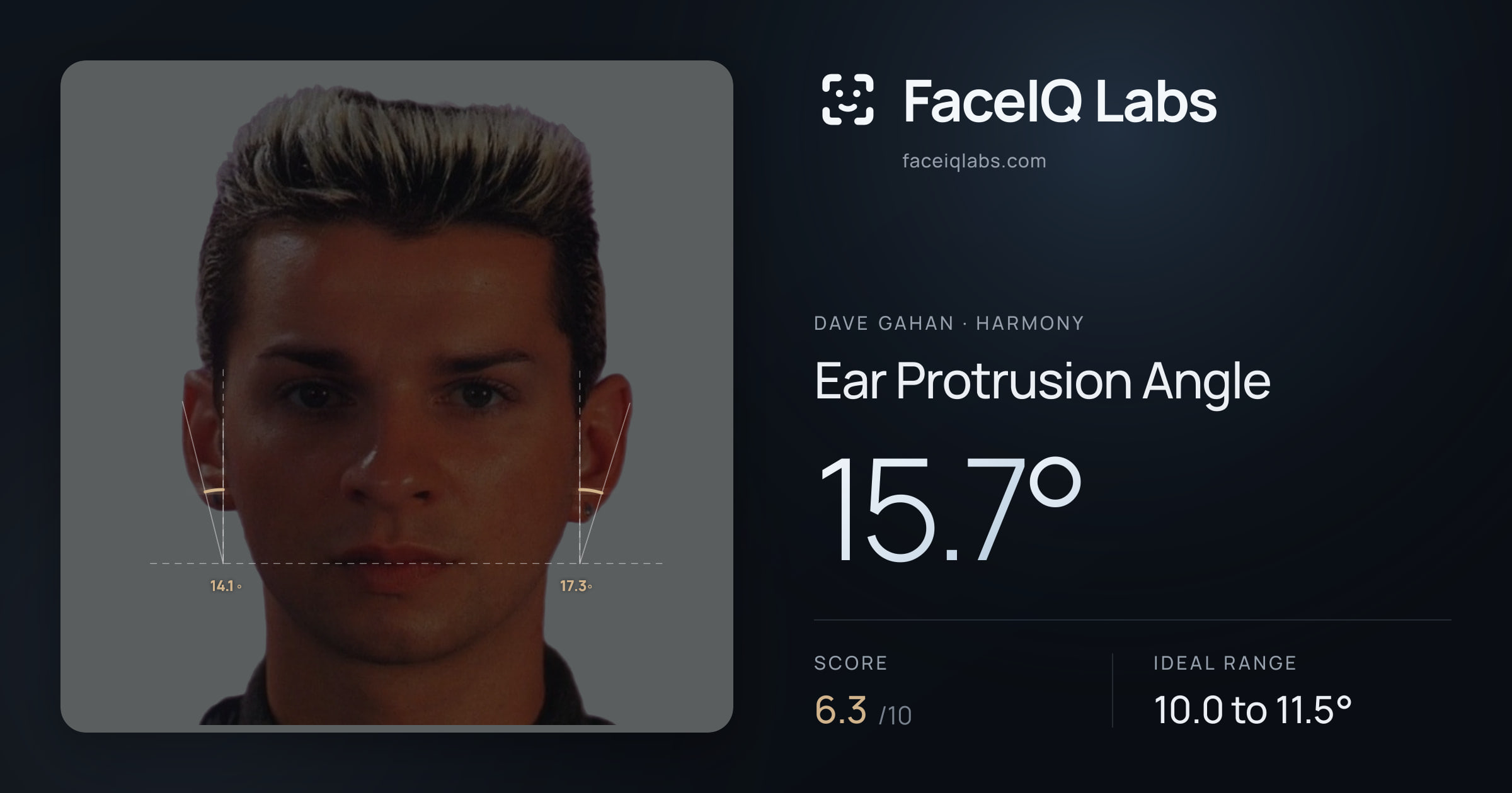Dave Gahan Ear Protrusion Angle: 15.7°, drawn on the photo