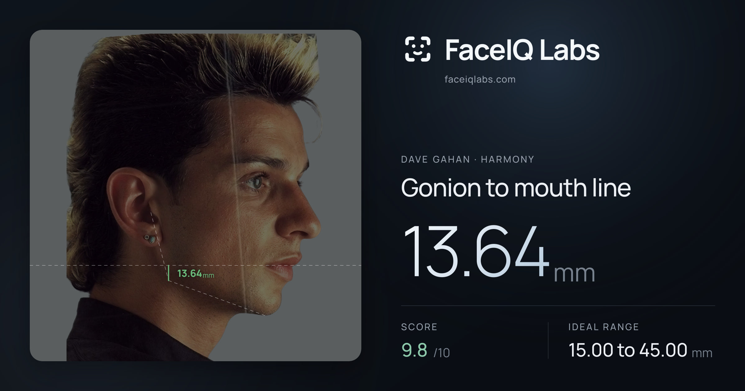 Dave Gahan Gonion to mouth line: 13.64mm, drawn on the photo