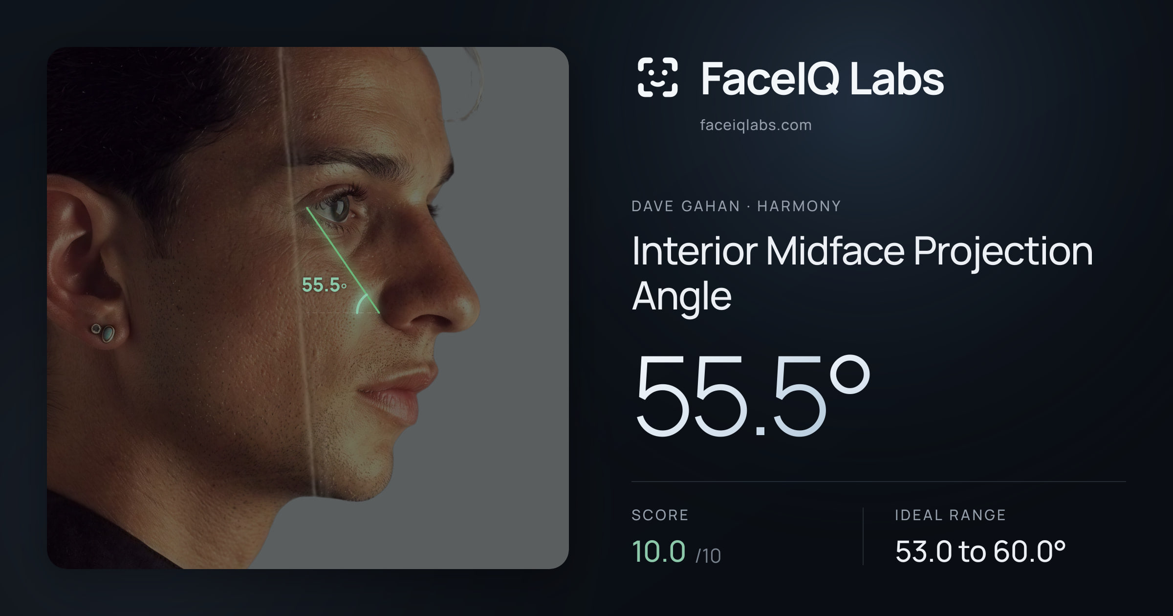 Dave Gahan Interior Midface Projection Angle: 55.5°, drawn on the photo