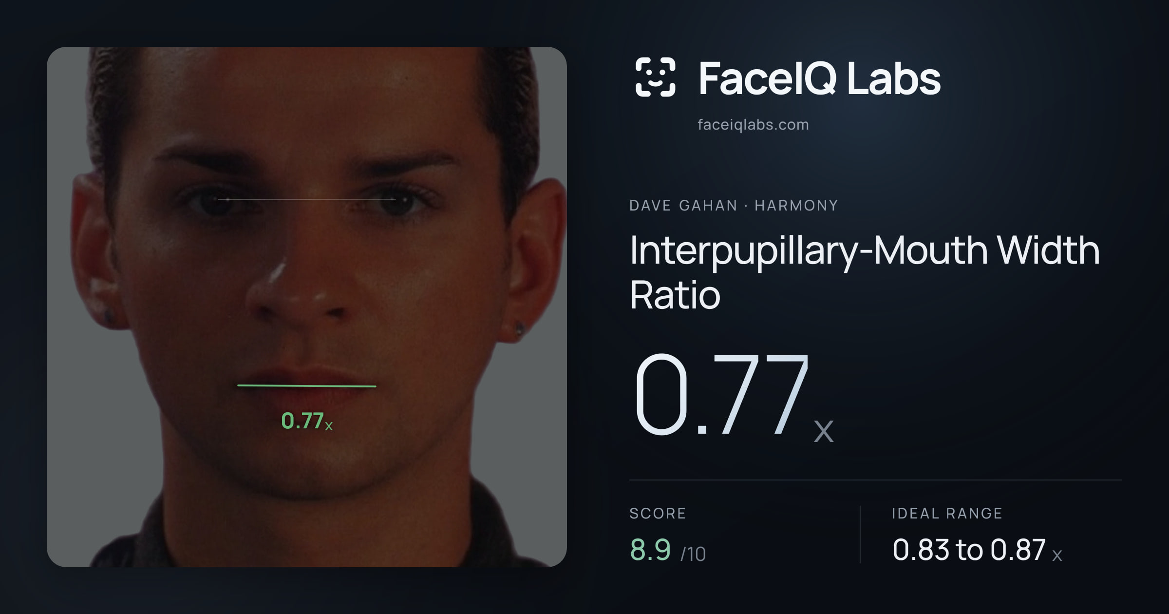Dave Gahan Interpupillary-Mouth Width Ratio: 0.77x, drawn on the photo