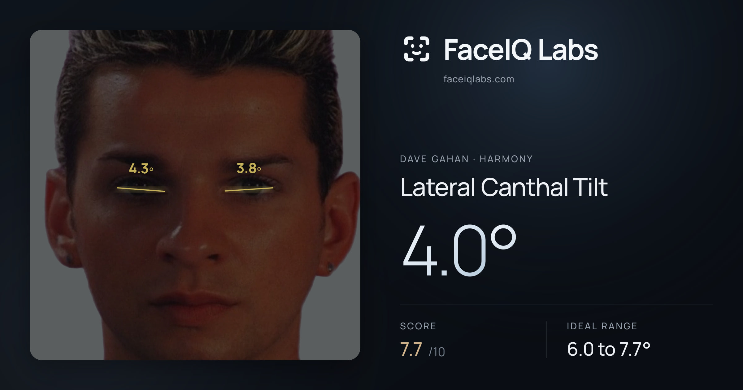 Dave Gahan Lateral Canthal Tilt: 4.0°, drawn on the photo