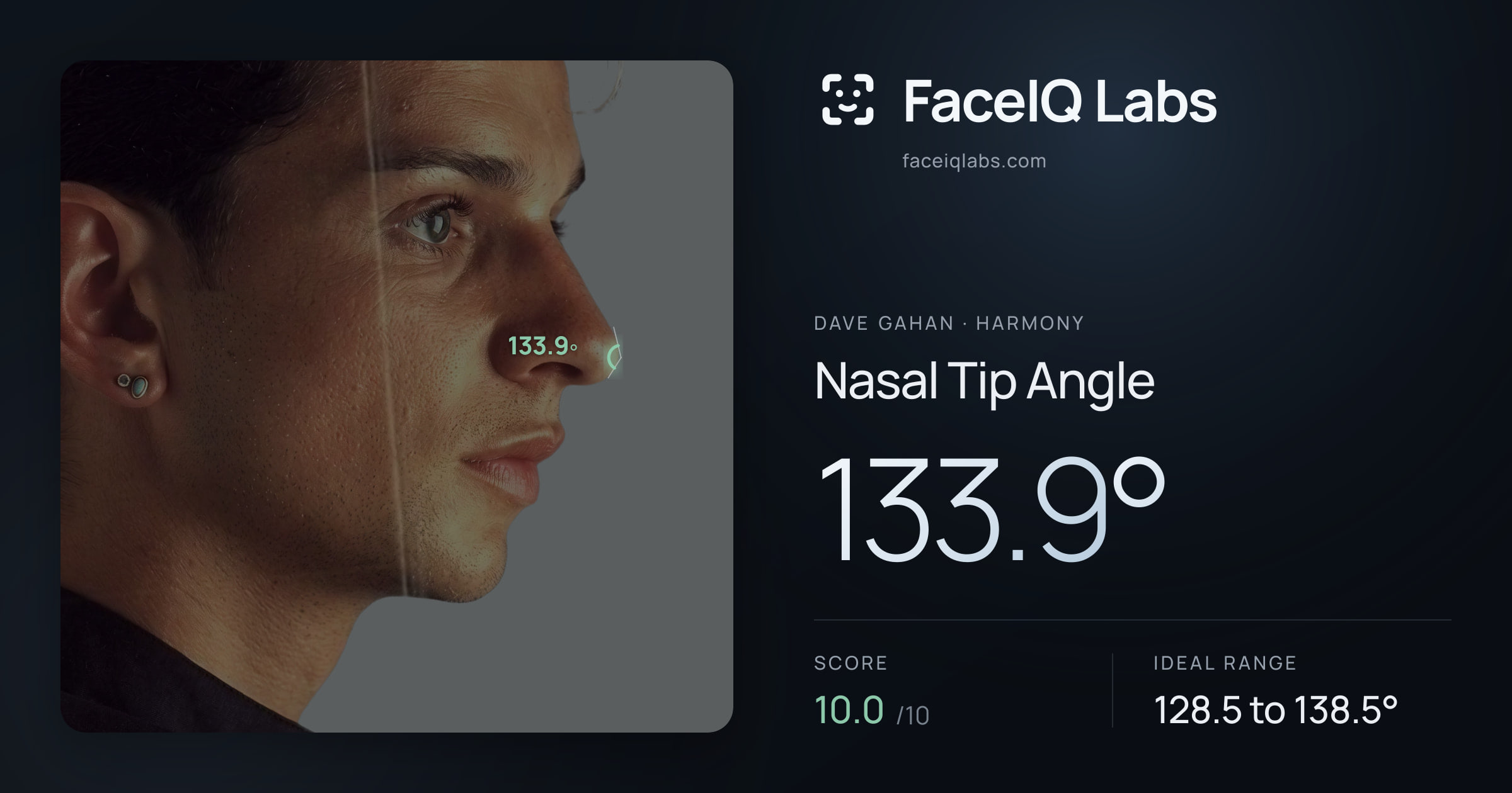 Dave Gahan Nasal Tip Angle: 133.9°, drawn on the photo