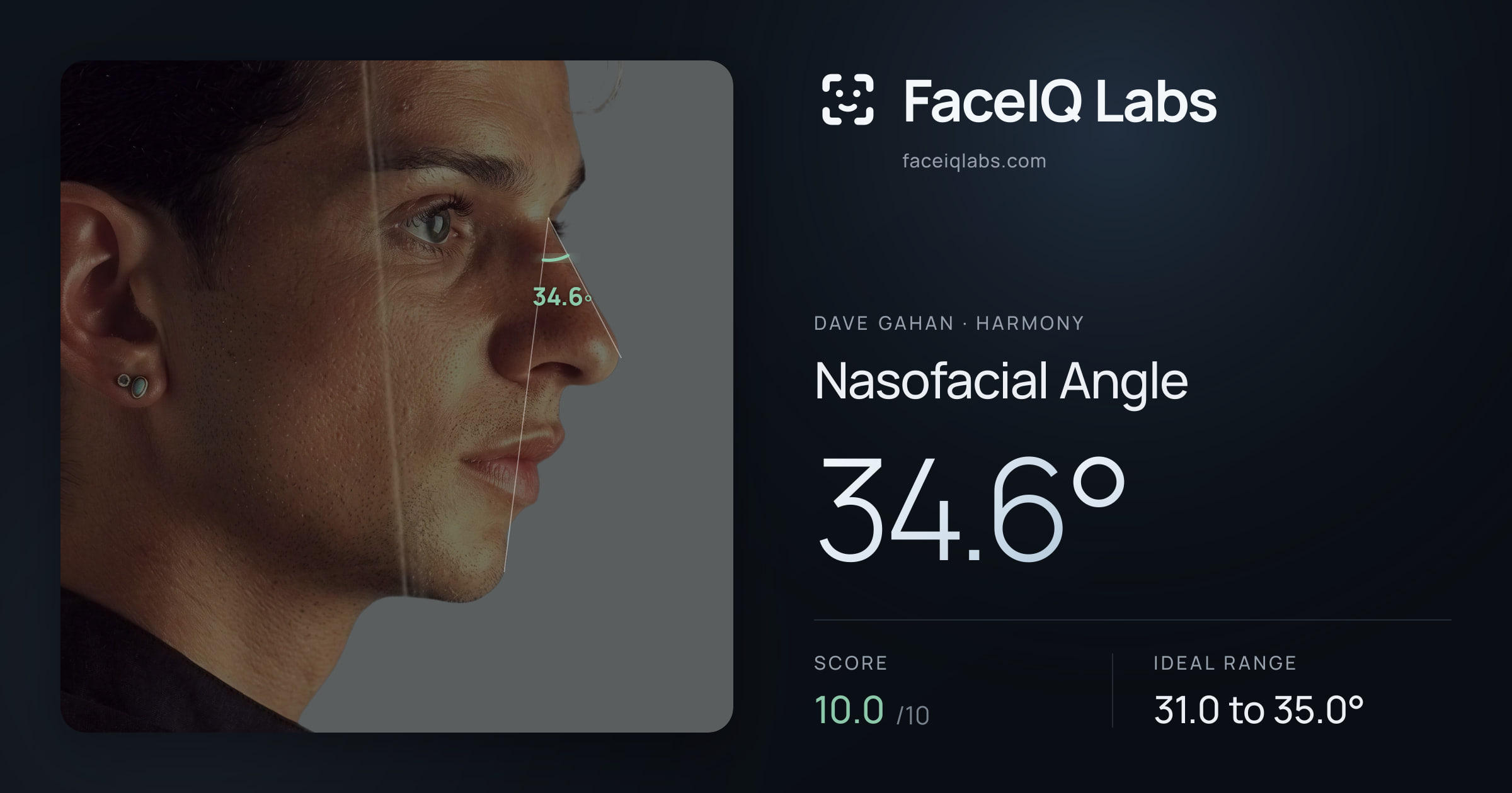 Dave Gahan Nasofacial Angle: 34.6°, drawn on the photo