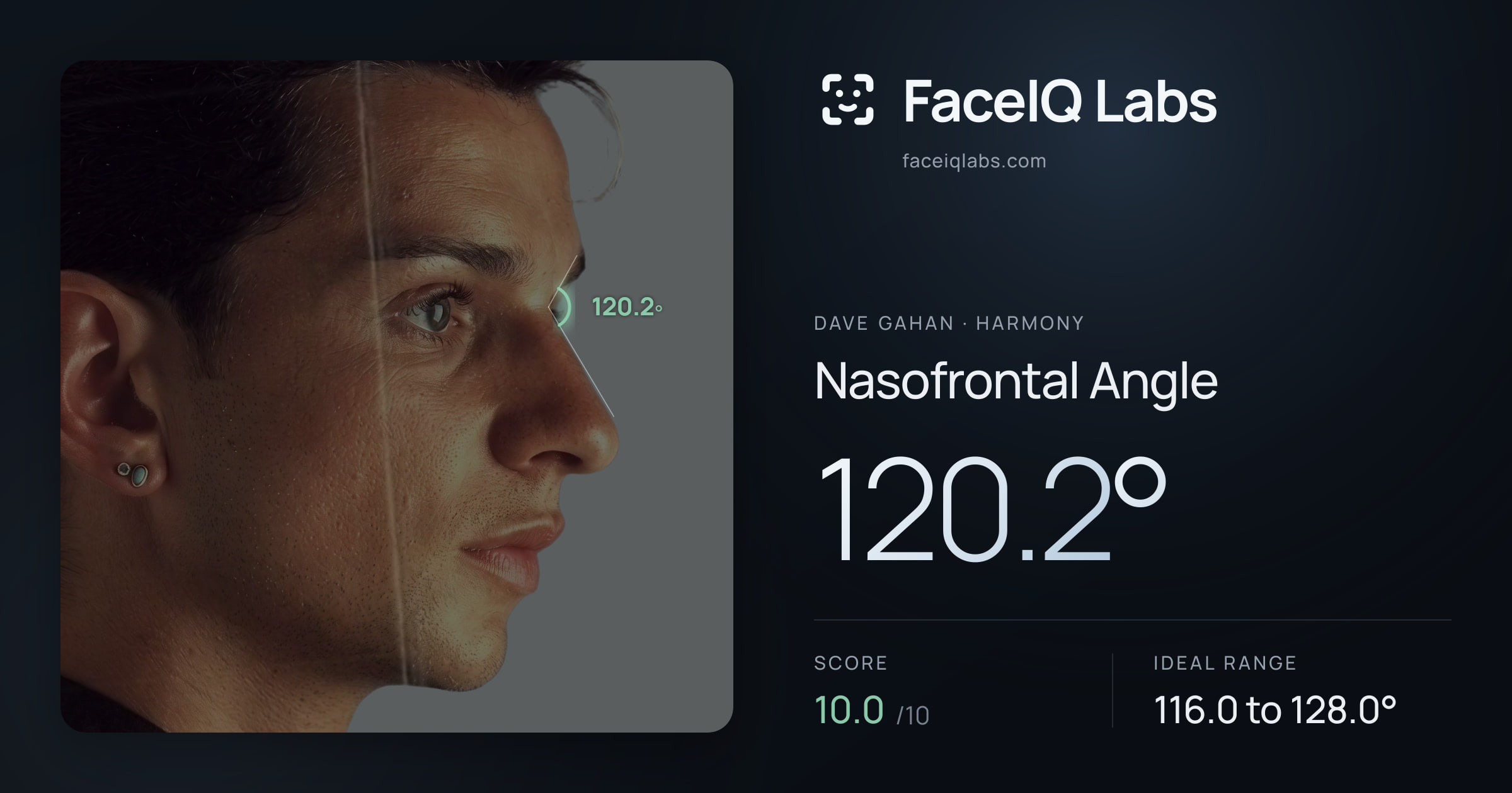 Dave Gahan Nasofrontal Angle: 120.2°, drawn on the photo
