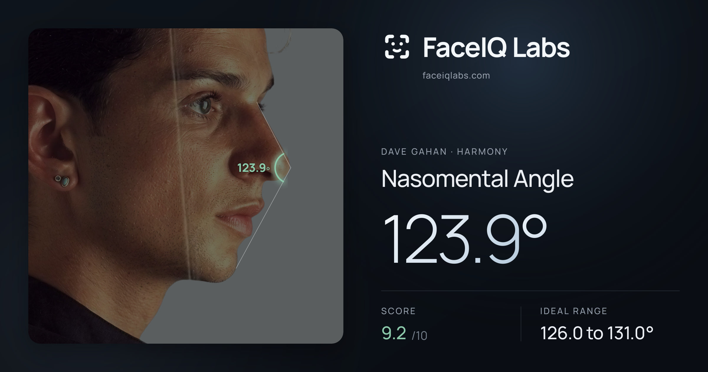 Dave Gahan Nasomental Angle: 123.9°, drawn on the photo