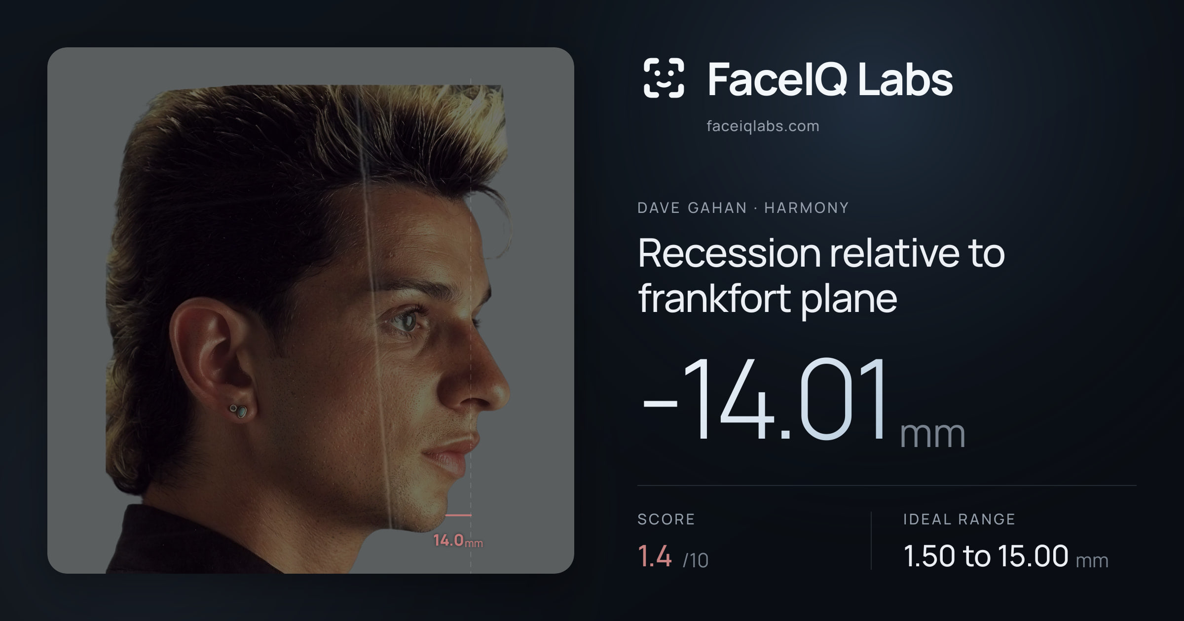 Dave Gahan Recession relative to frankfort plane: -14.01mm, drawn on the photo