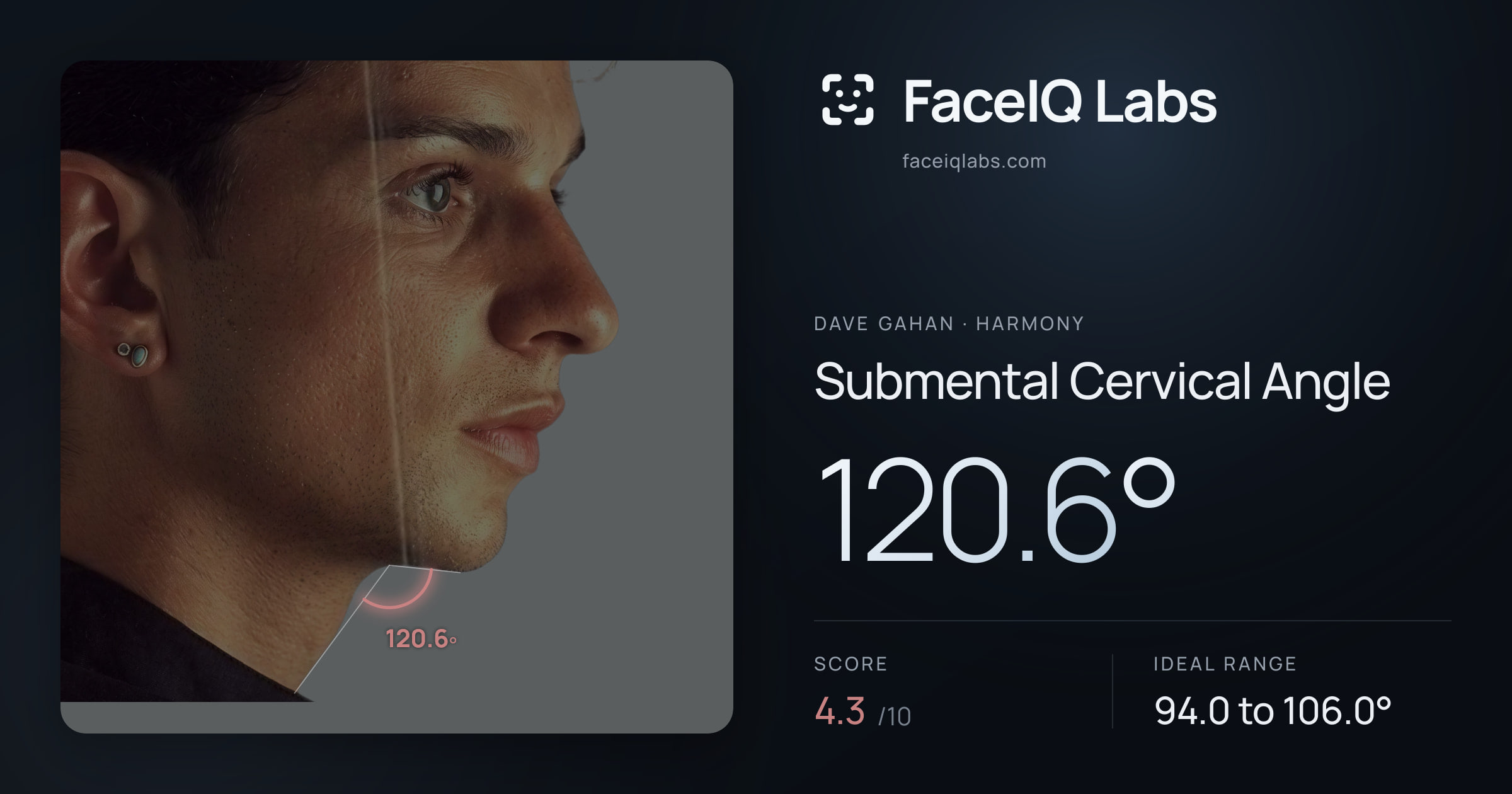 Dave Gahan Submental Cervical Angle: 120.6°, drawn on the photo