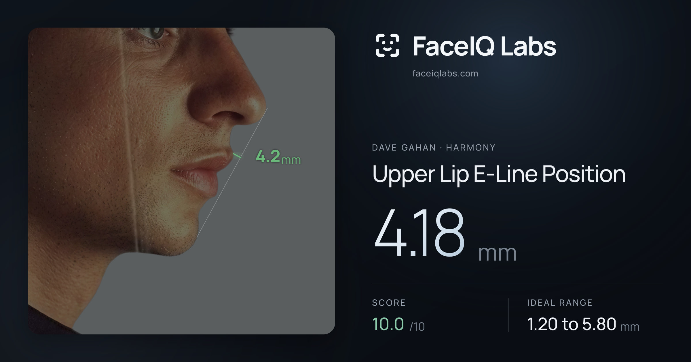 Dave Gahan Upper Lip E-Line Position: 4.18mm, drawn on the photo
