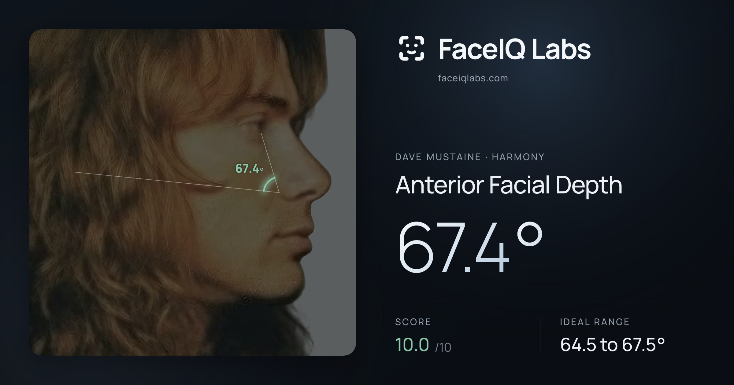 Dave Mustaine Anterior Facial Depth: 67.4°, drawn on the photo