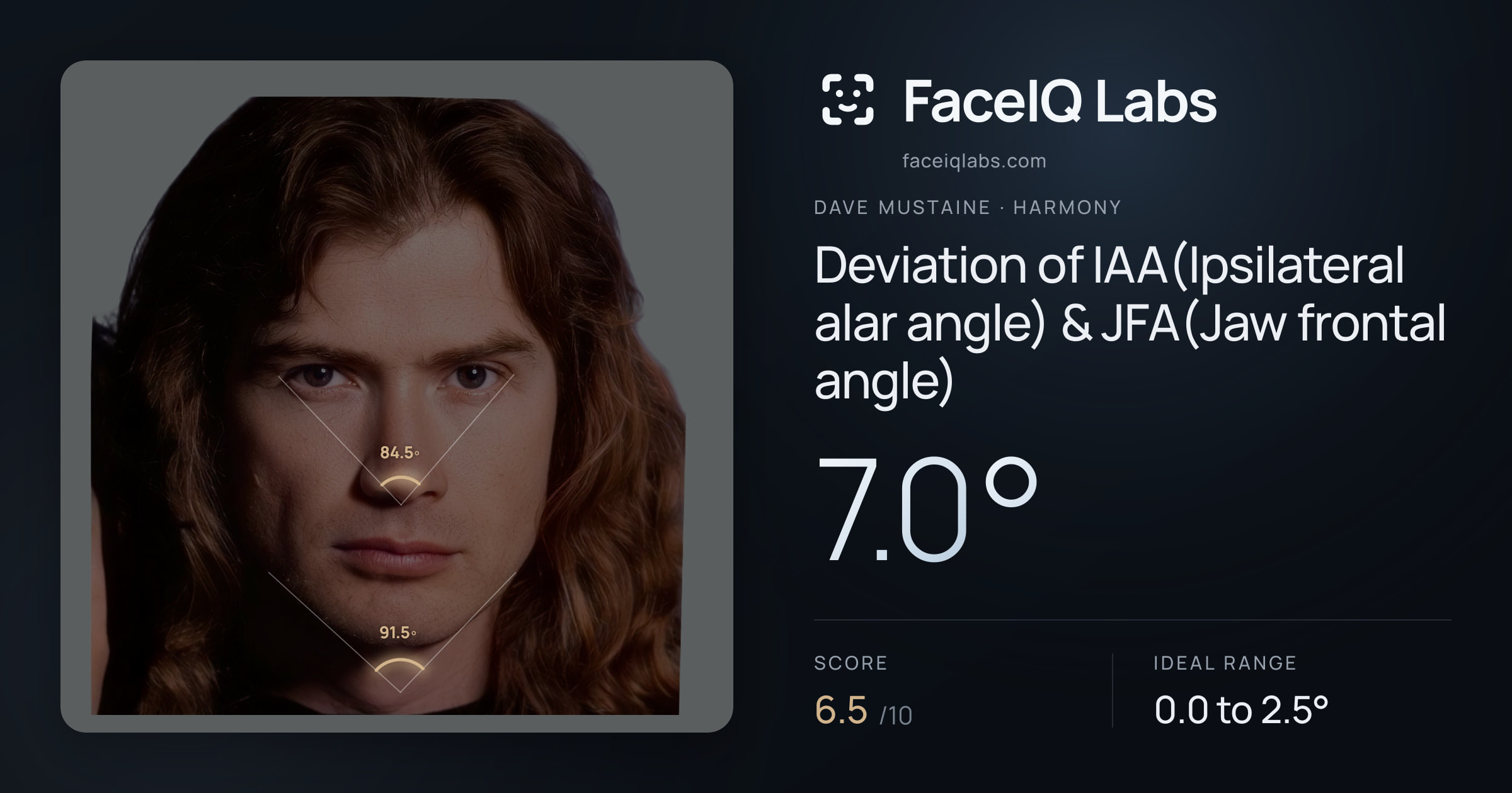 Dave Mustaine Deviation of IAA(Ipsilateral alar angle) & JFA(Jaw frontal angle): 7.0°, drawn on the photo