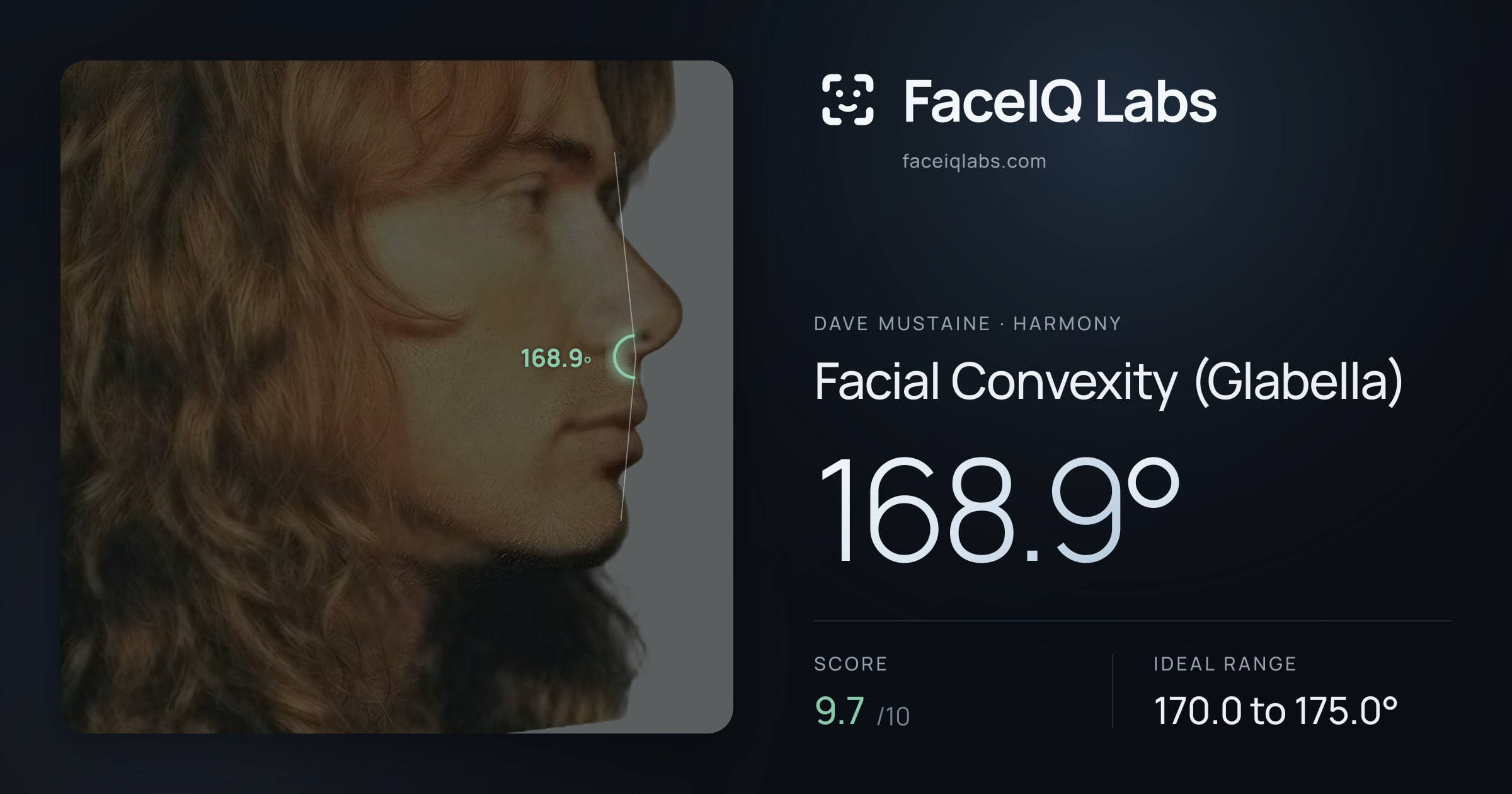 Dave Mustaine Facial Convexity (Glabella): 168.9°, drawn on the photo