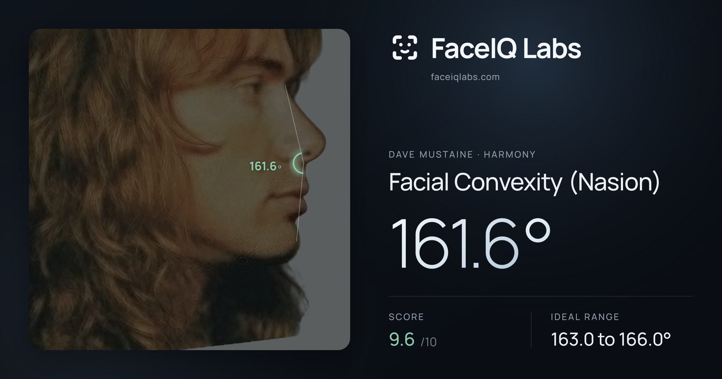 Dave Mustaine Facial Convexity (Nasion): 161.6°, drawn on the photo