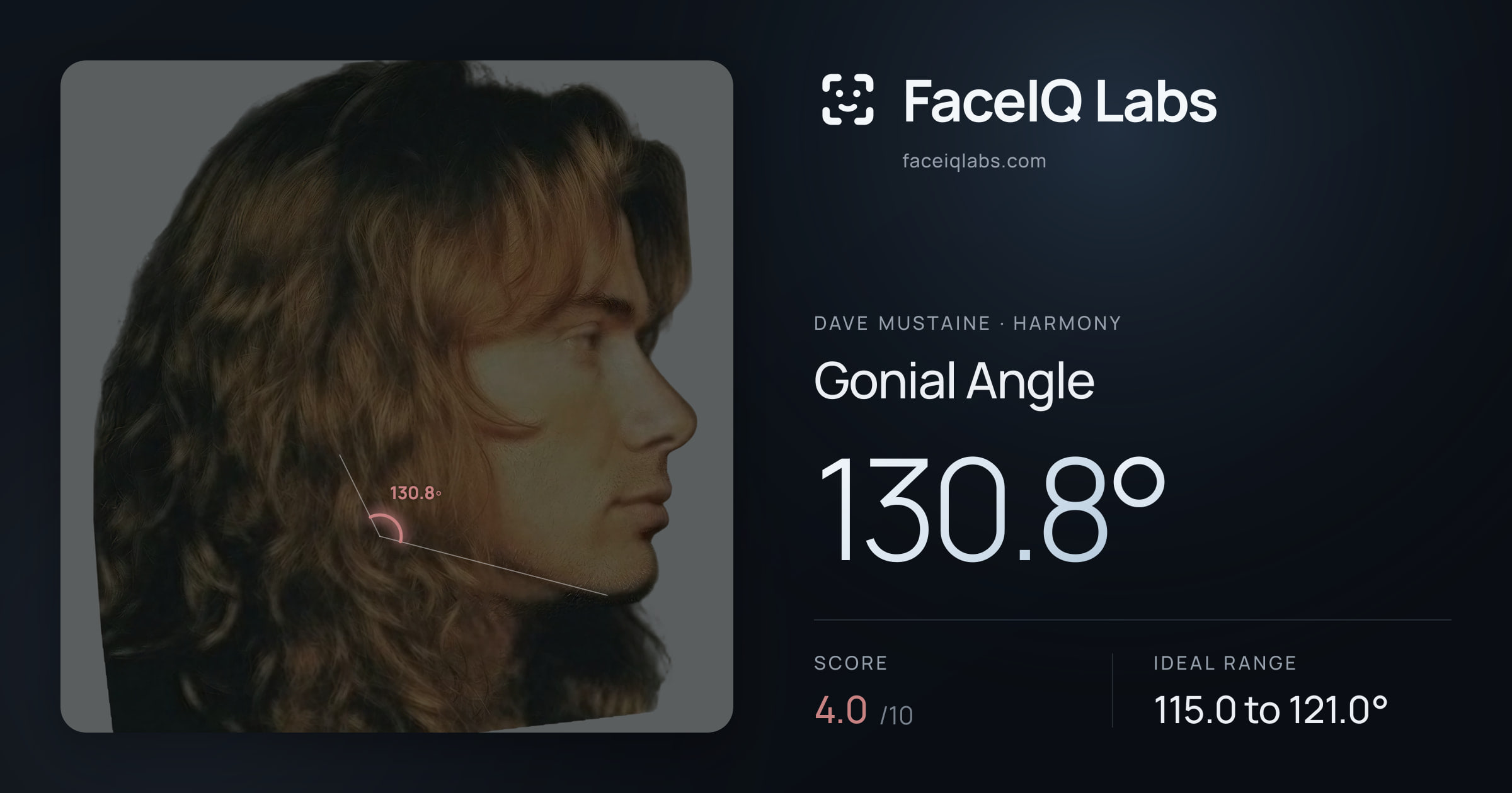 Dave Mustaine Gonial Angle: 130.8°, drawn on the photo