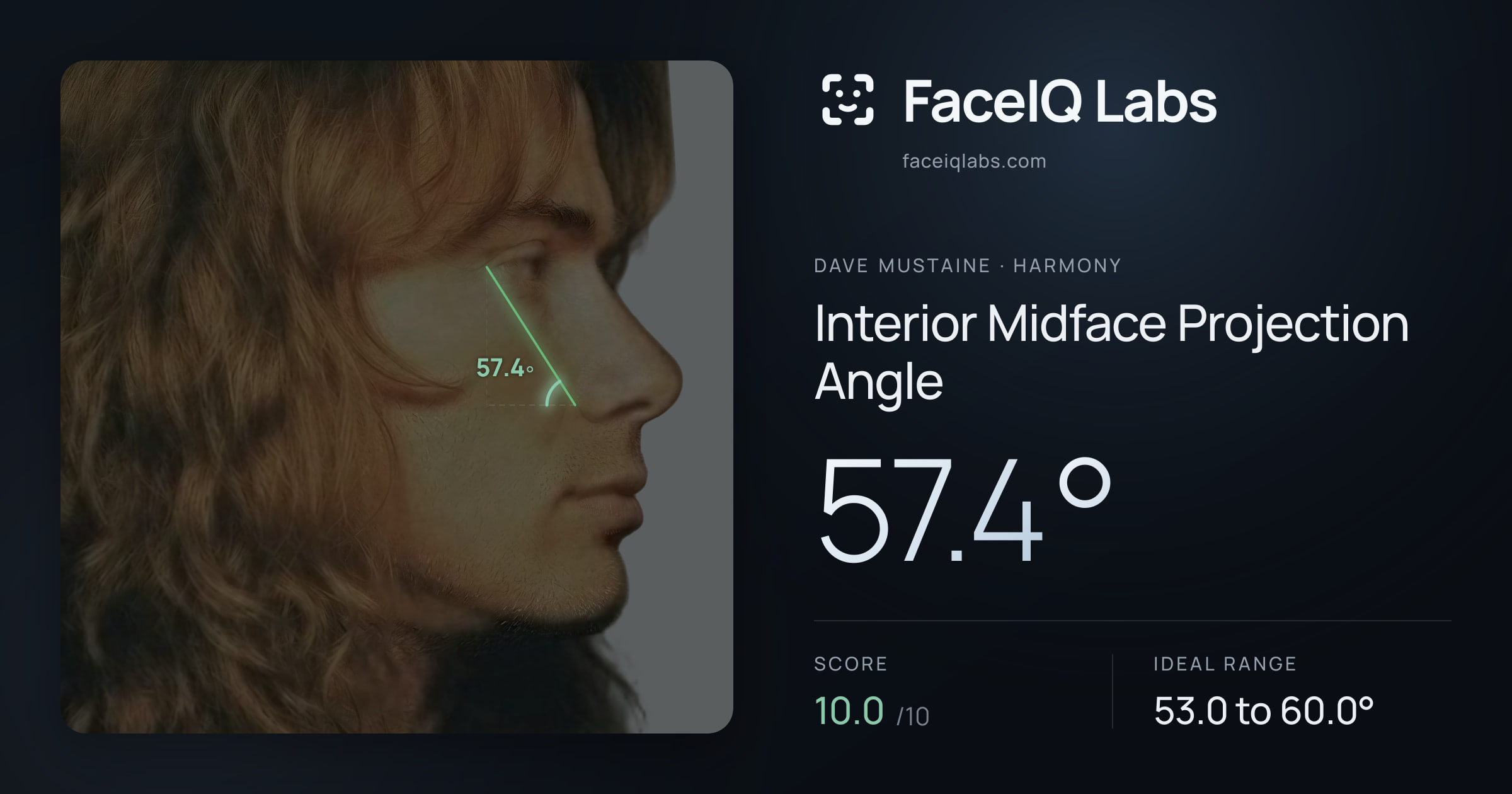 Dave Mustaine Interior Midface Projection Angle: 57.4°, drawn on the photo
