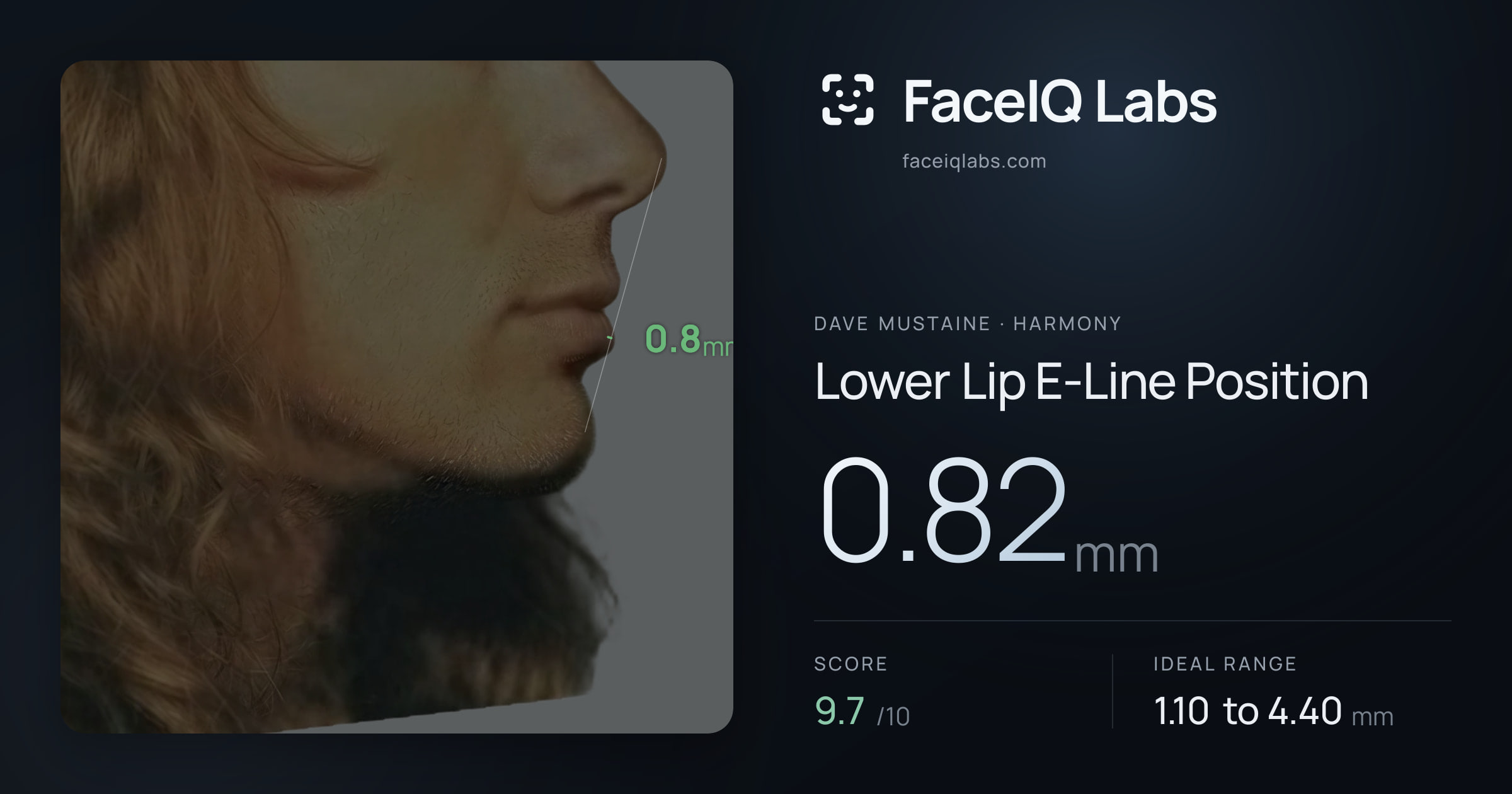 Dave Mustaine Lower Lip E-Line Position: 0.82mm, drawn on the photo