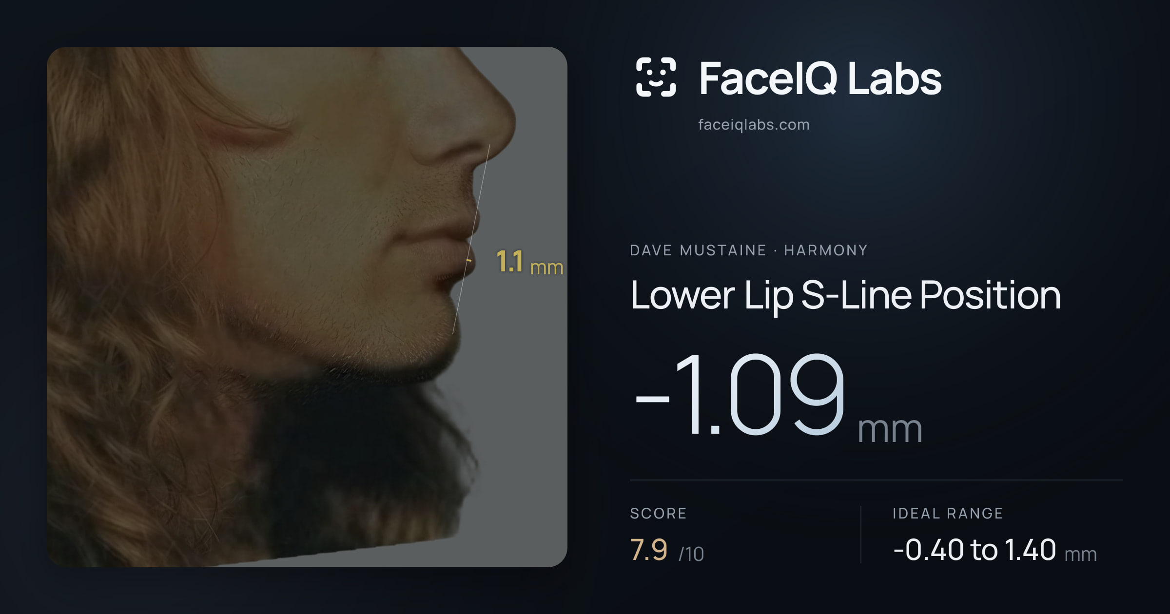 Dave Mustaine Lower Lip S-Line Position: -1.09mm, drawn on the photo