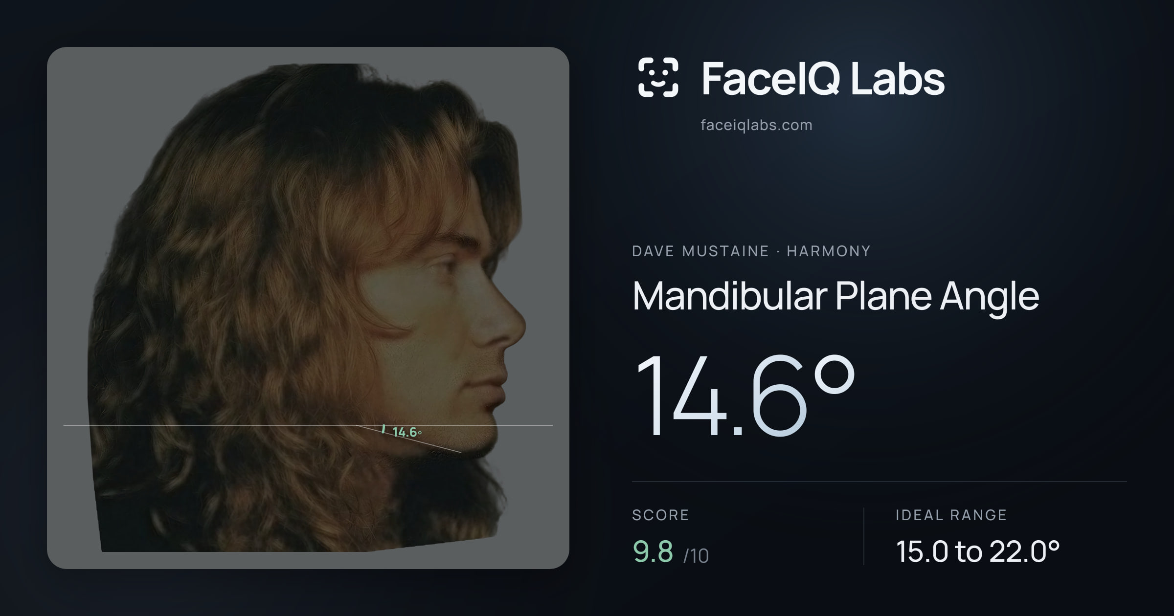 Dave Mustaine Mandibular Plane Angle: 14.6°, drawn on the photo