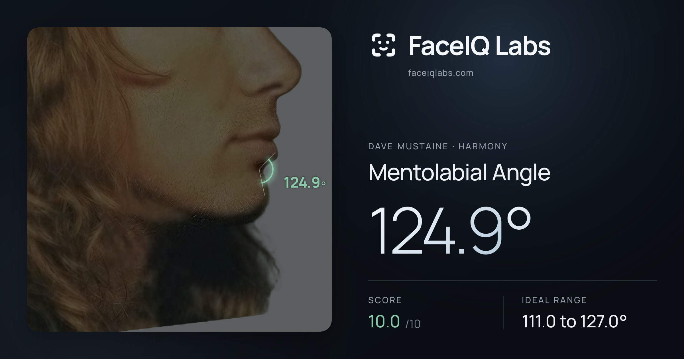 Dave Mustaine Mentolabial Angle: 124.9°, drawn on the photo