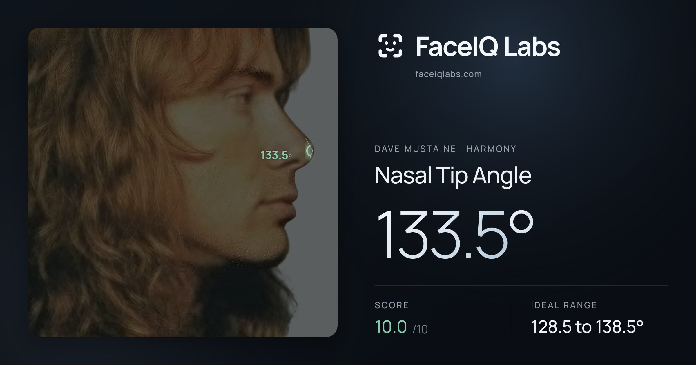 Dave Mustaine Nasal Tip Angle: 133.5°, drawn on the photo