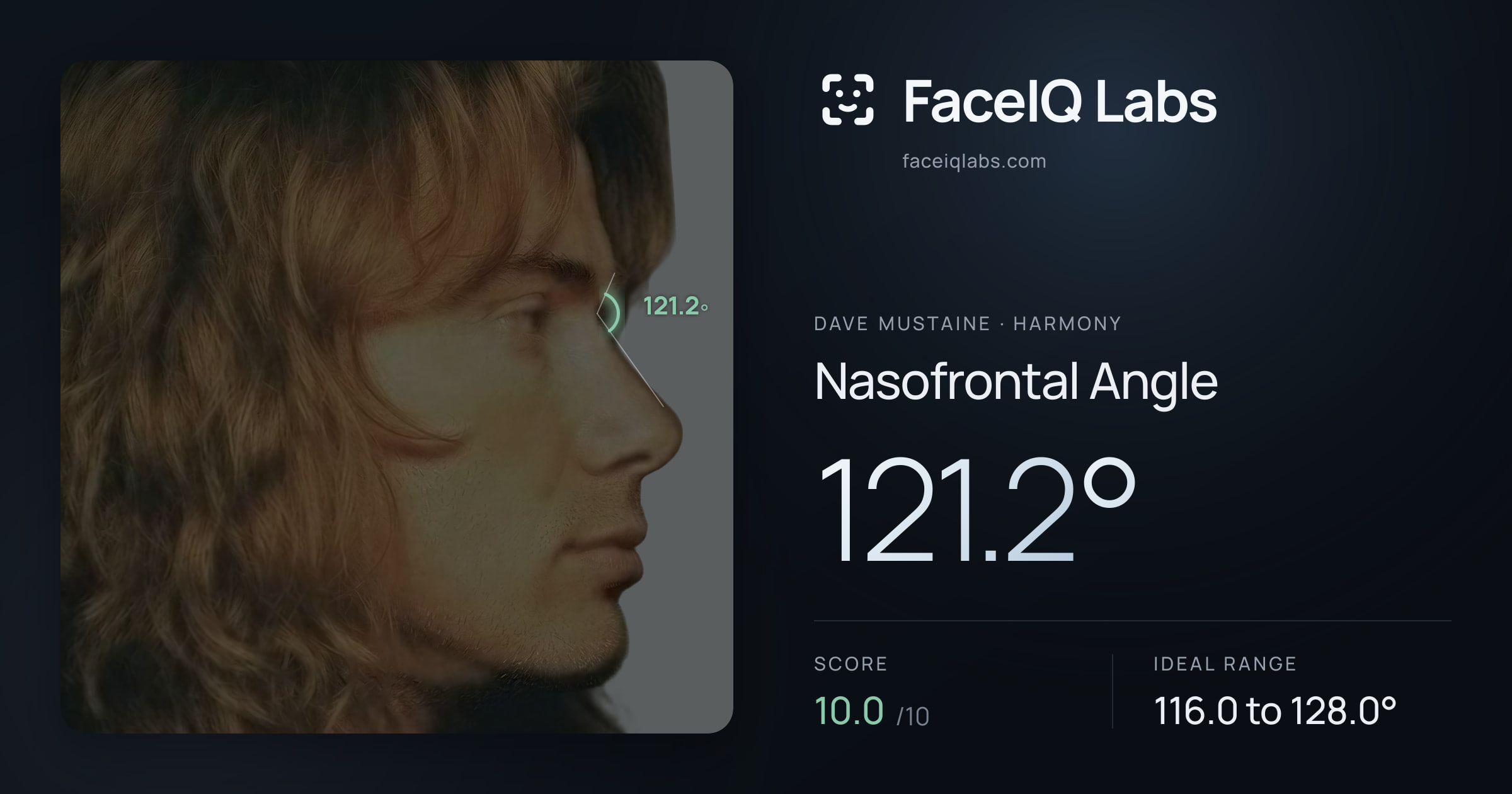 Dave Mustaine Nasofrontal Angle: 121.2°, drawn on the photo