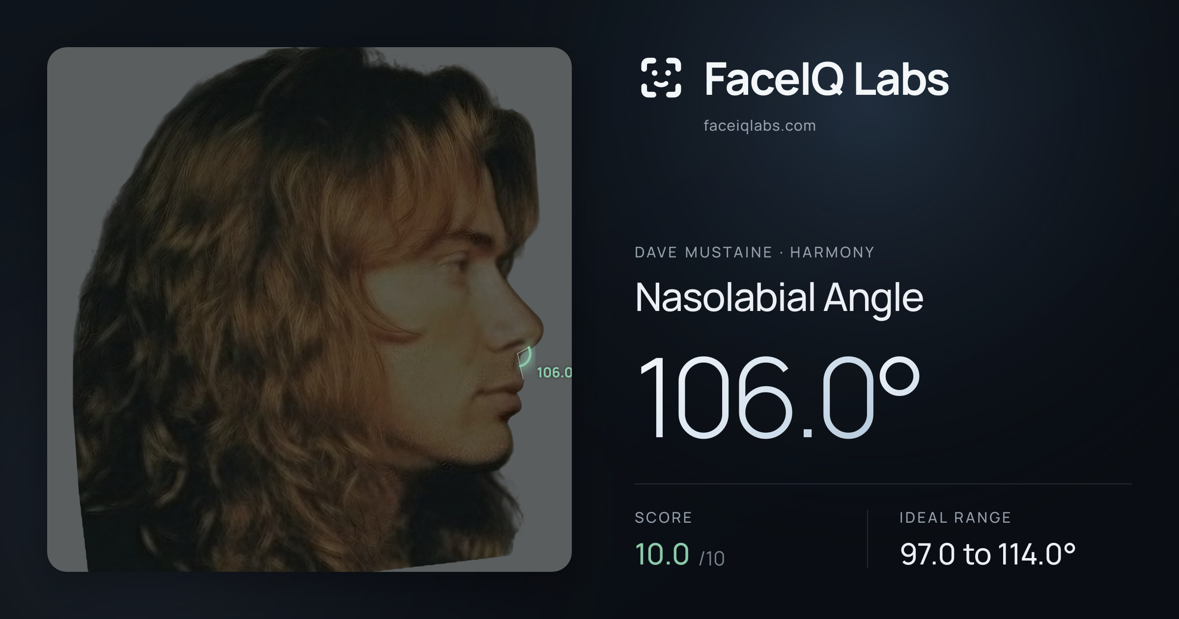 Dave Mustaine Nasolabial Angle: 106.0°, drawn on the photo