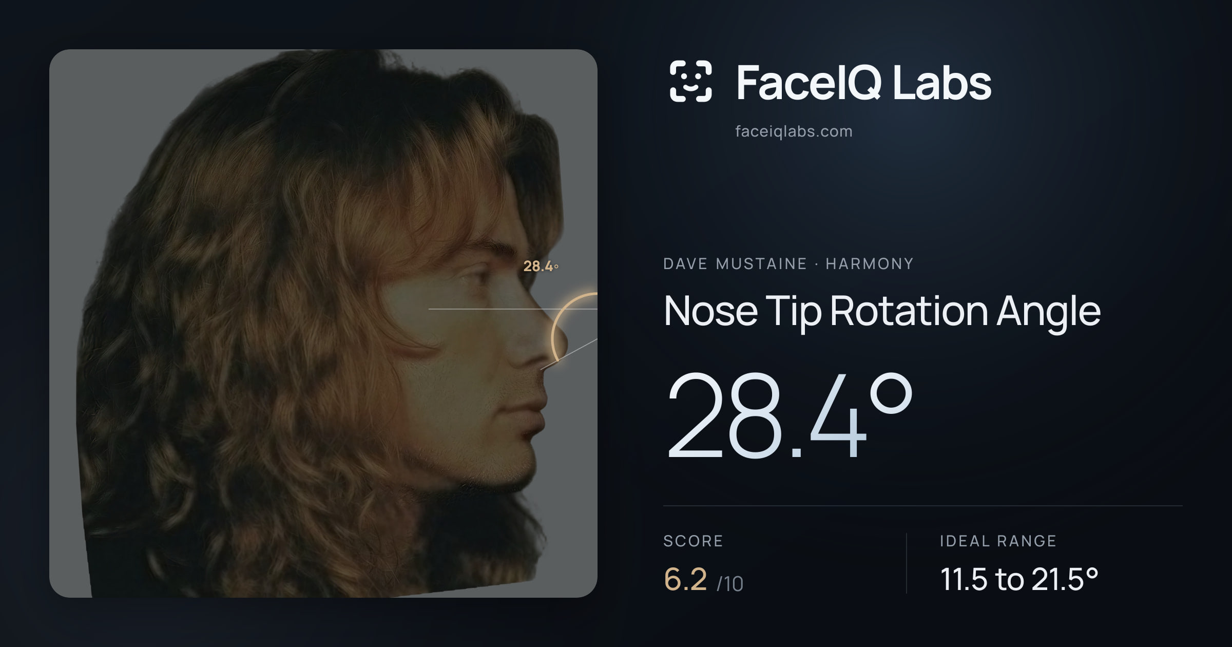 Dave Mustaine Nose Tip Rotation Angle: 28.4°, drawn on the photo