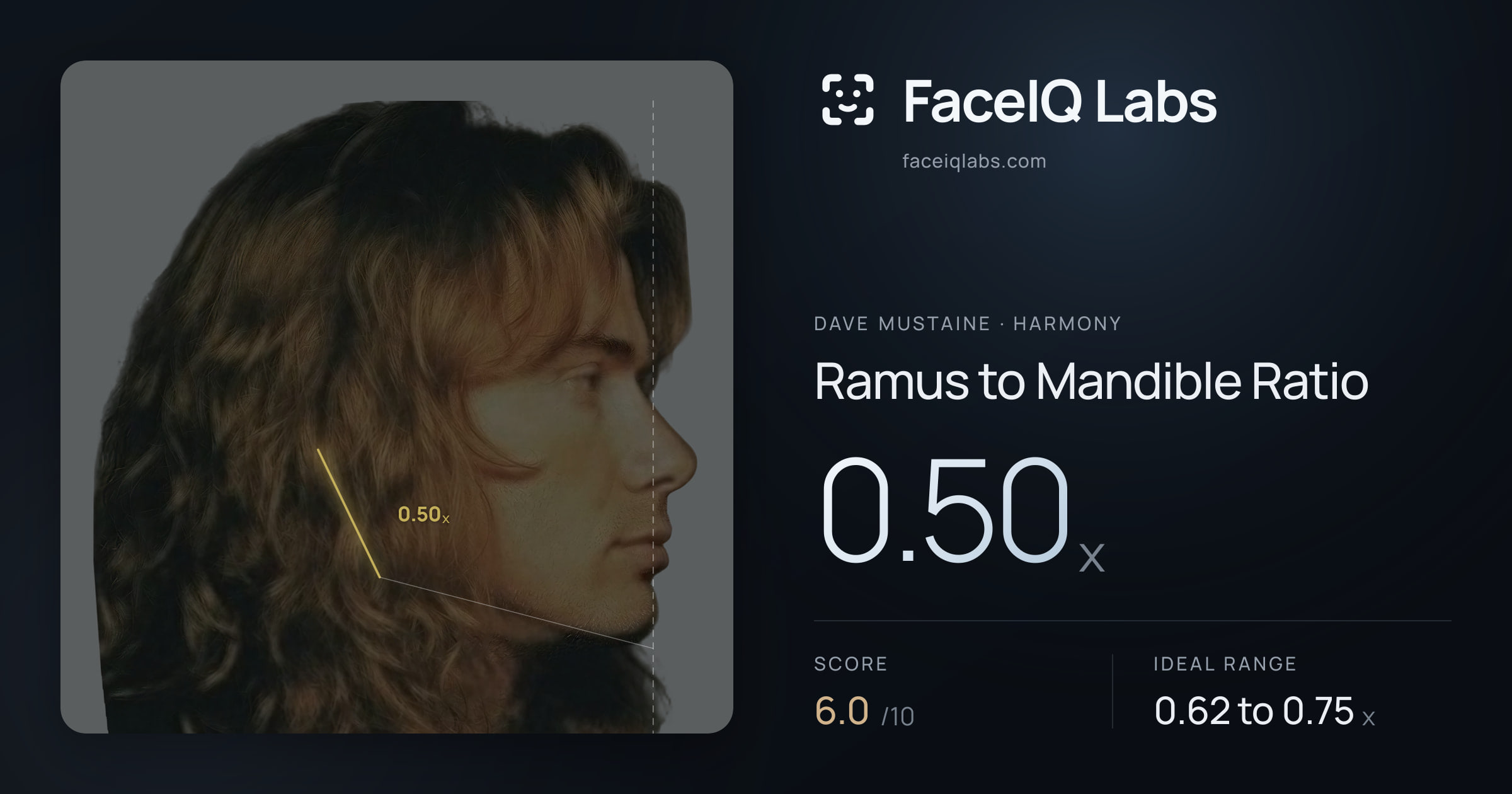 Dave Mustaine Ramus to Mandible Ratio: 0.50x, drawn on the photo