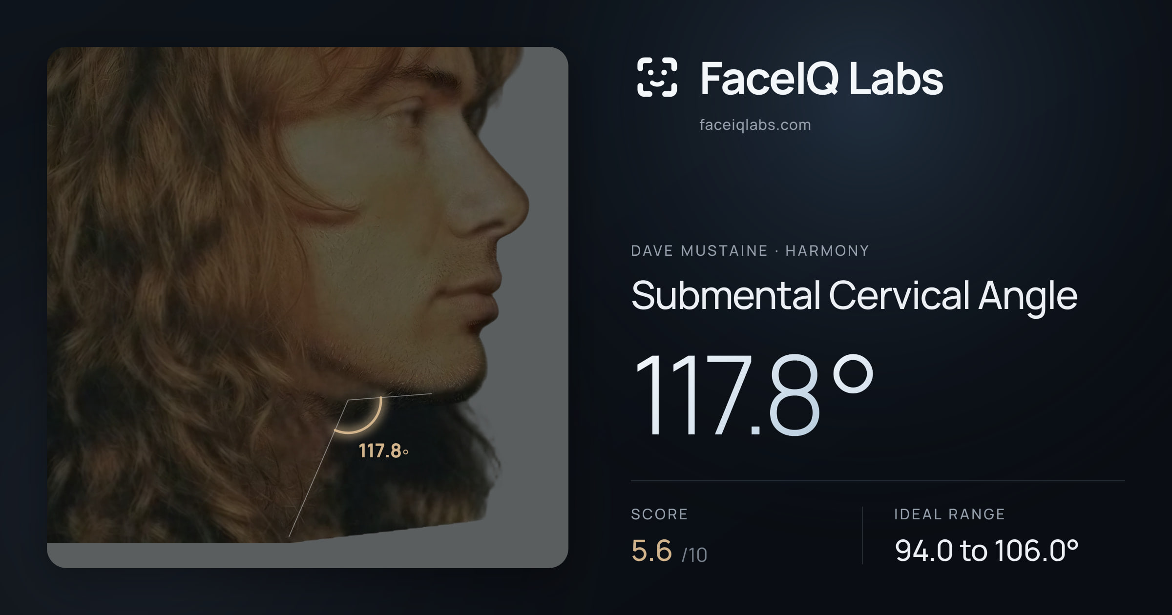 Dave Mustaine Submental Cervical Angle: 117.8°, drawn on the photo