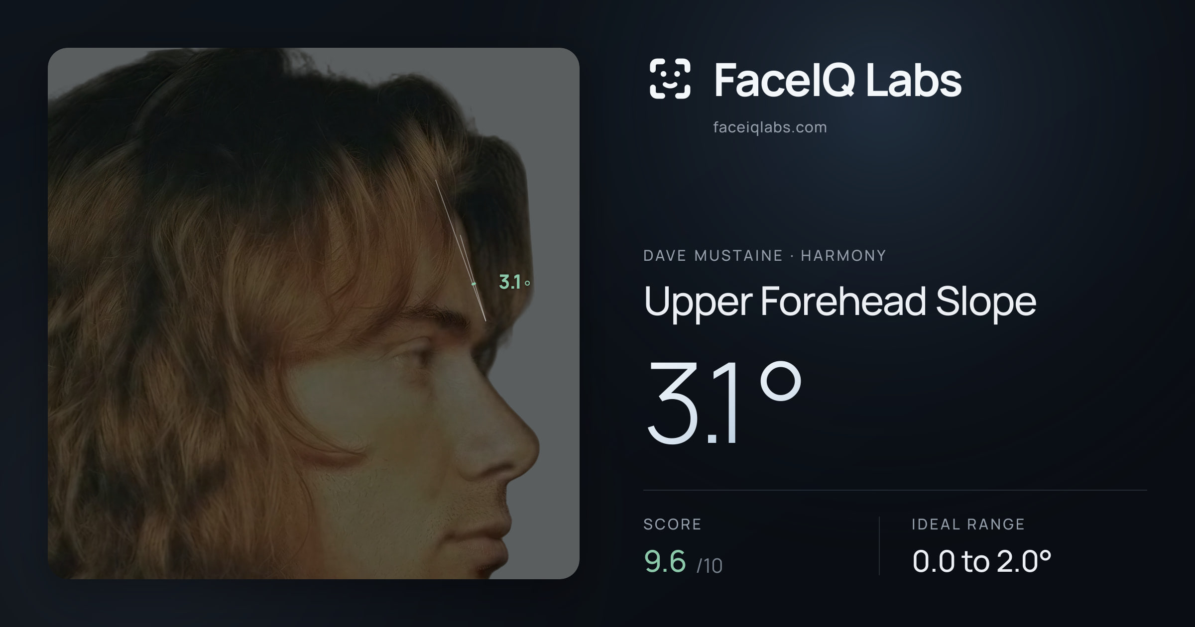 Dave Mustaine Upper Forehead Slope: 3.1°, drawn on the photo
