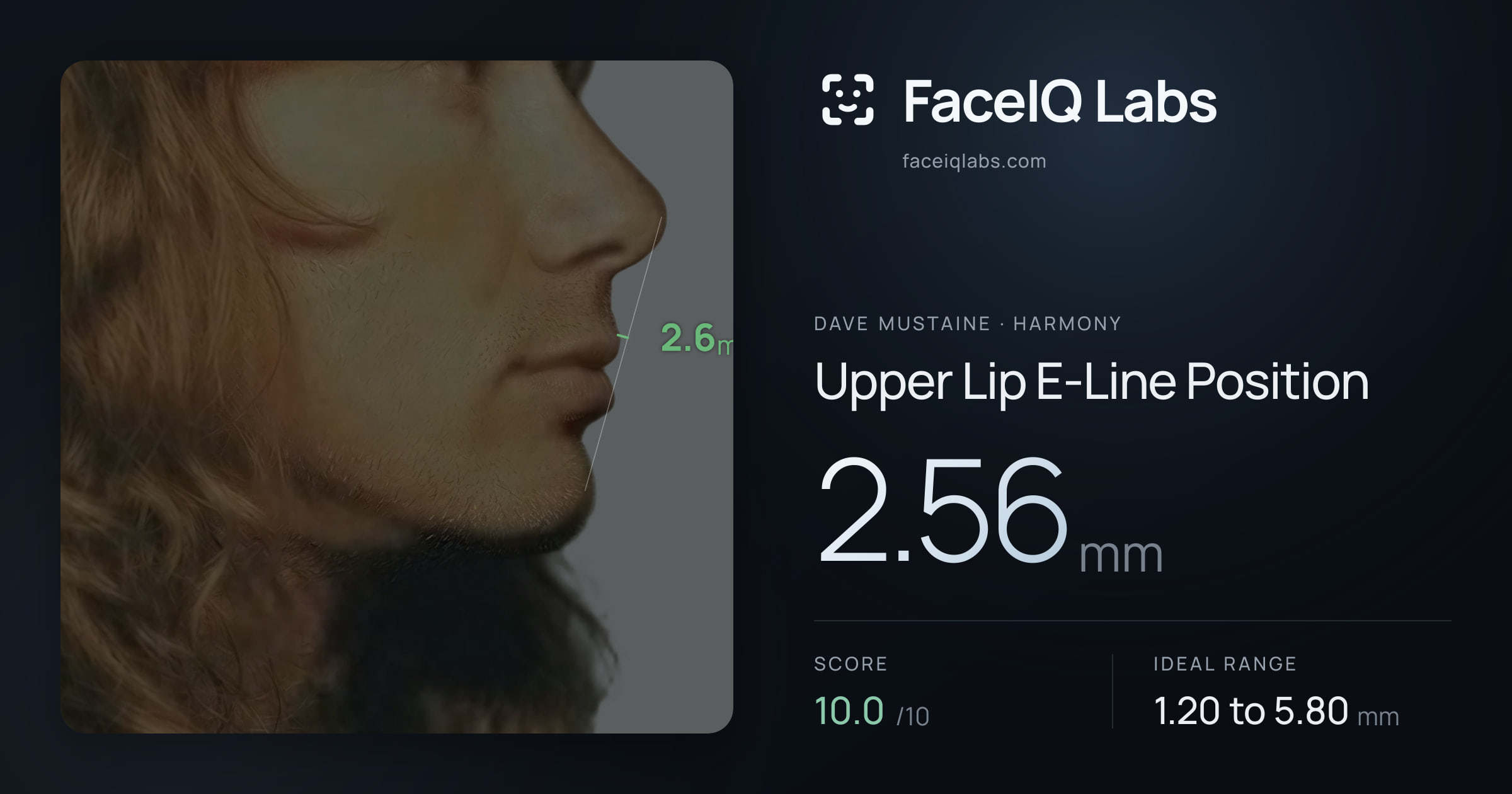 Dave Mustaine Upper Lip E-Line Position: 2.56mm, drawn on the photo