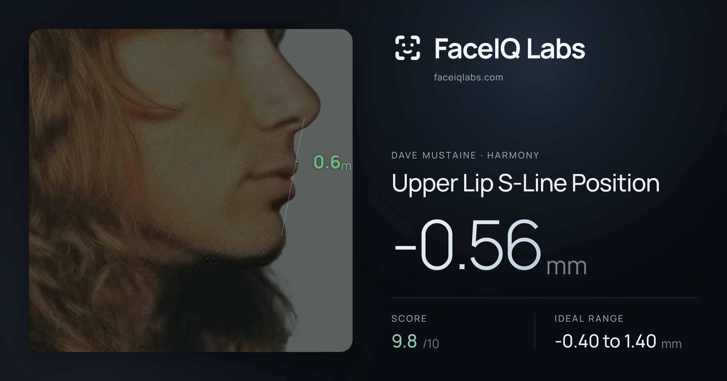 Dave Mustaine Upper Lip S-Line Position: -0.56mm, drawn on the photo