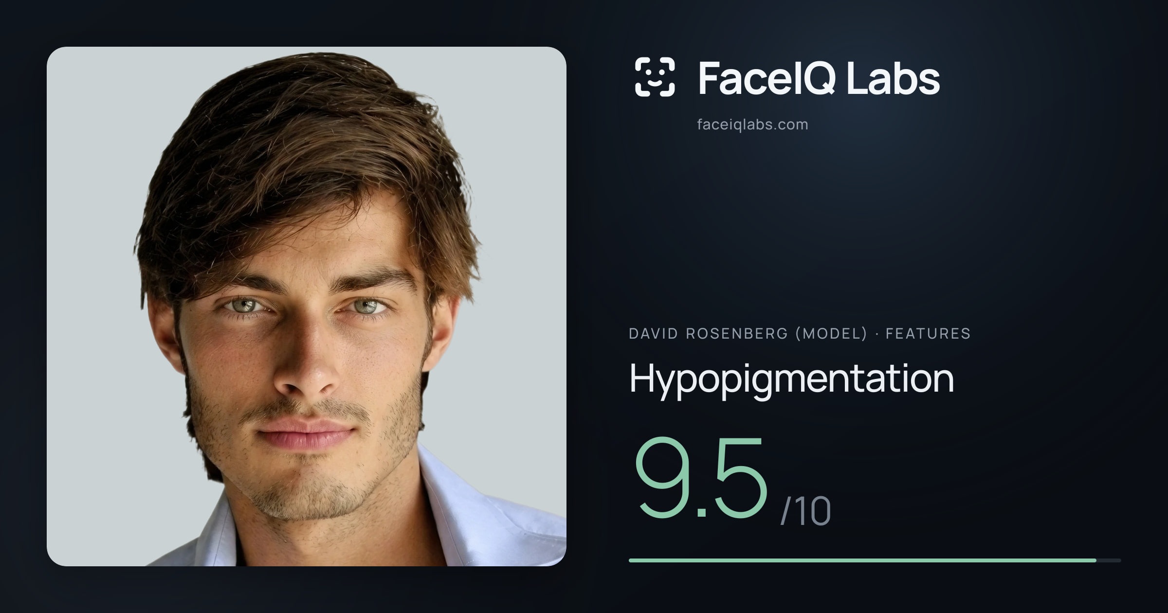 David Rosenberg (Model) Hypopigmentation: 9.5/10, drawn on the photo
