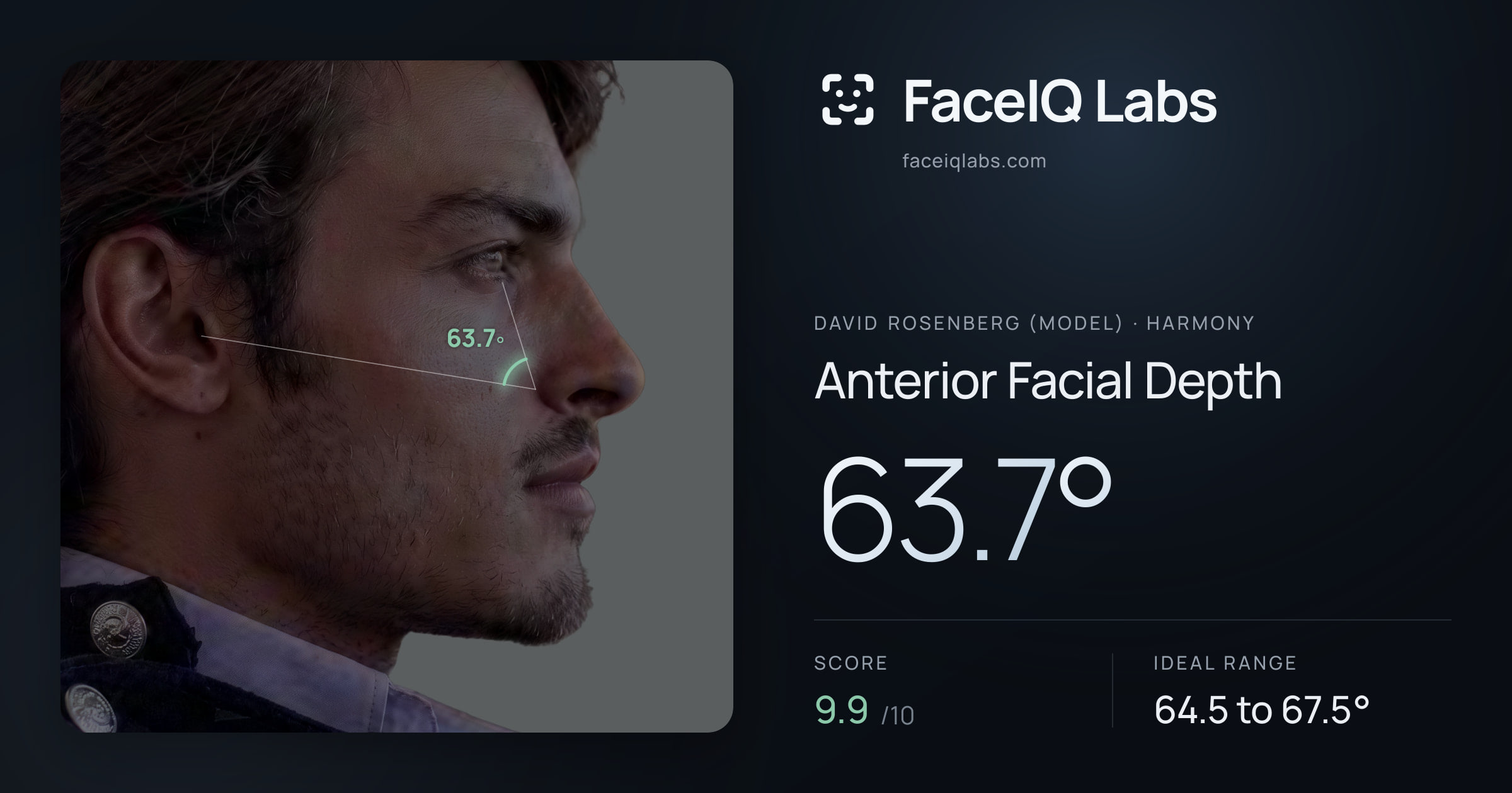 David Rosenberg (Model) Anterior Facial Depth: 63.7°, drawn on the photo